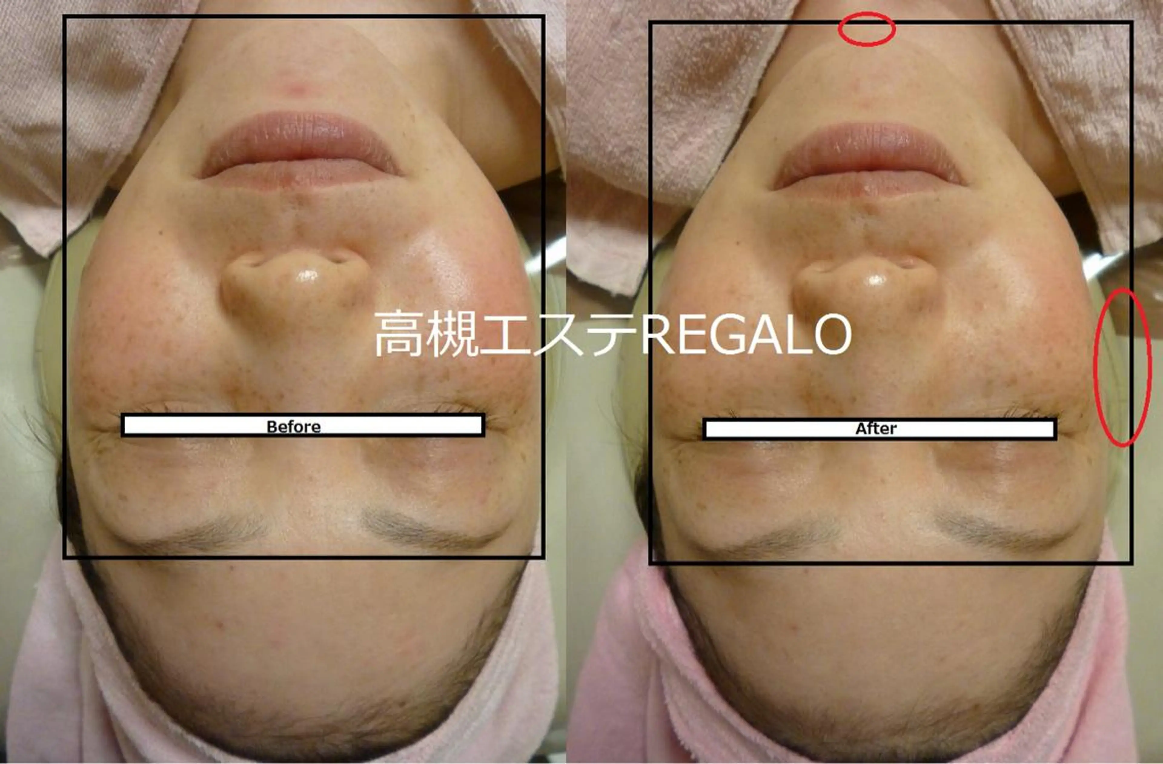 REGALO所属・矢野 さやかのエステ・リラクイメージ