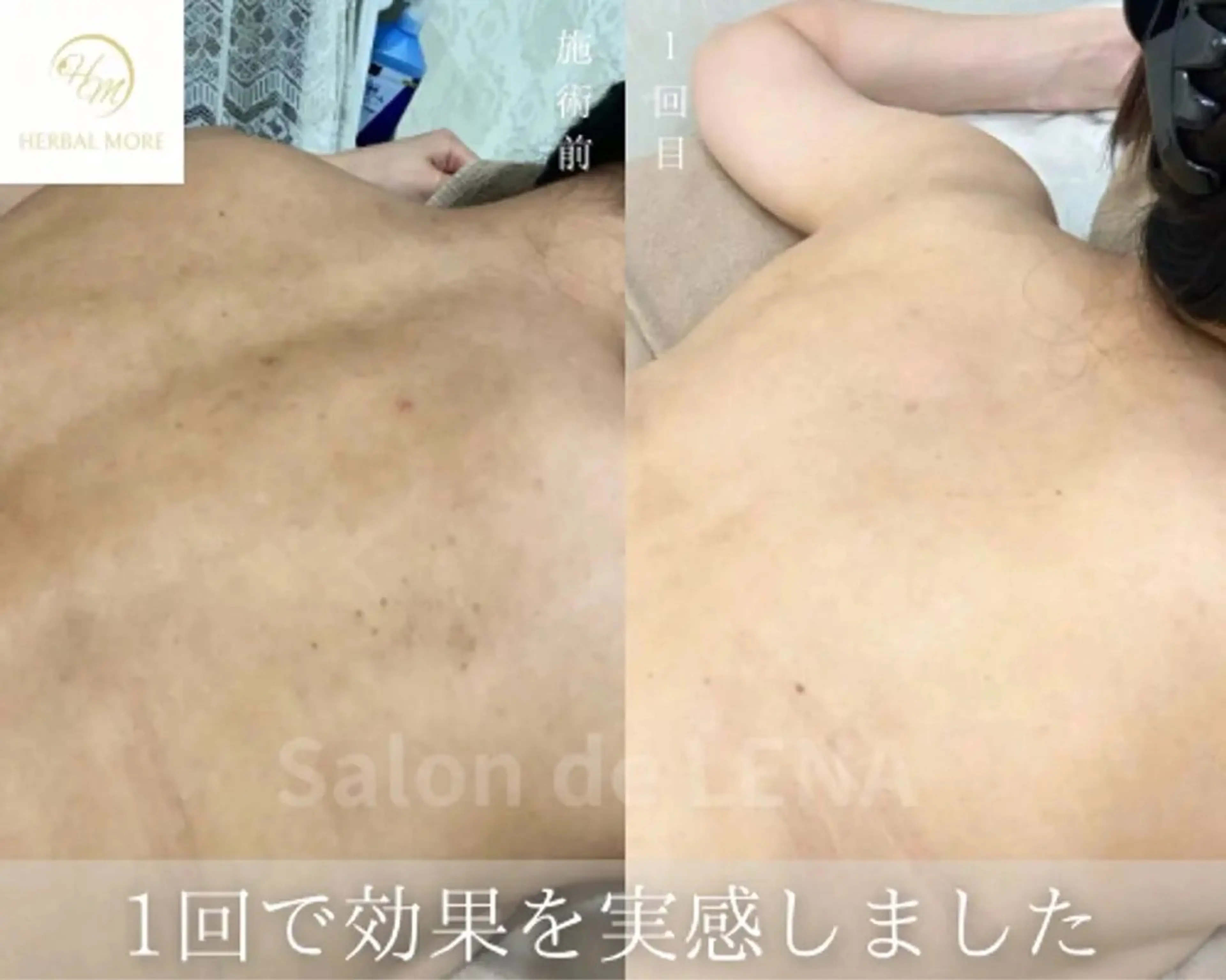 Grandir所属・ハーブピーリング専門 グランディール　武内のエステ・リラクイメージ