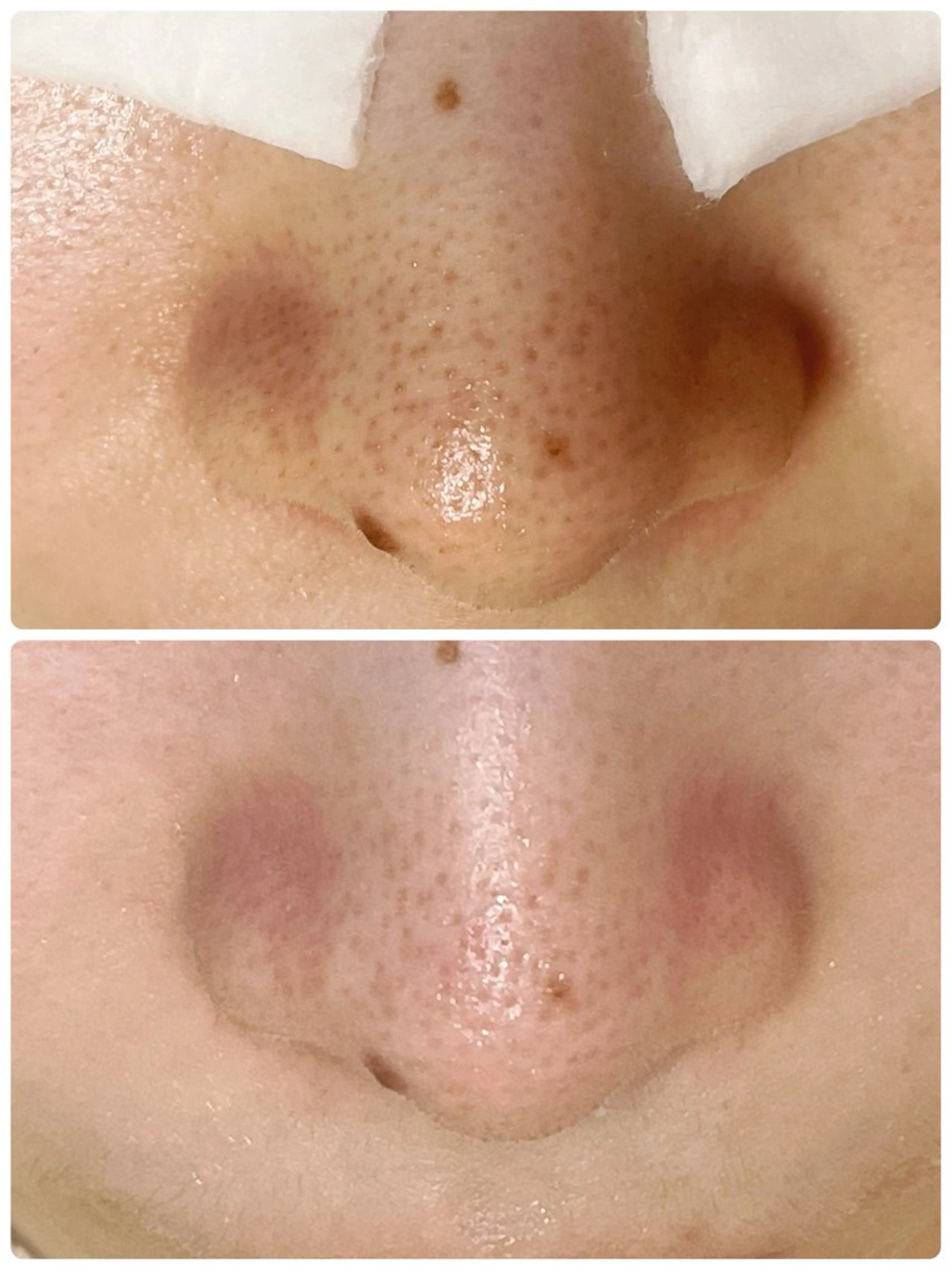 トータルビューティー サロンLilyのエステ・リラクイメージ