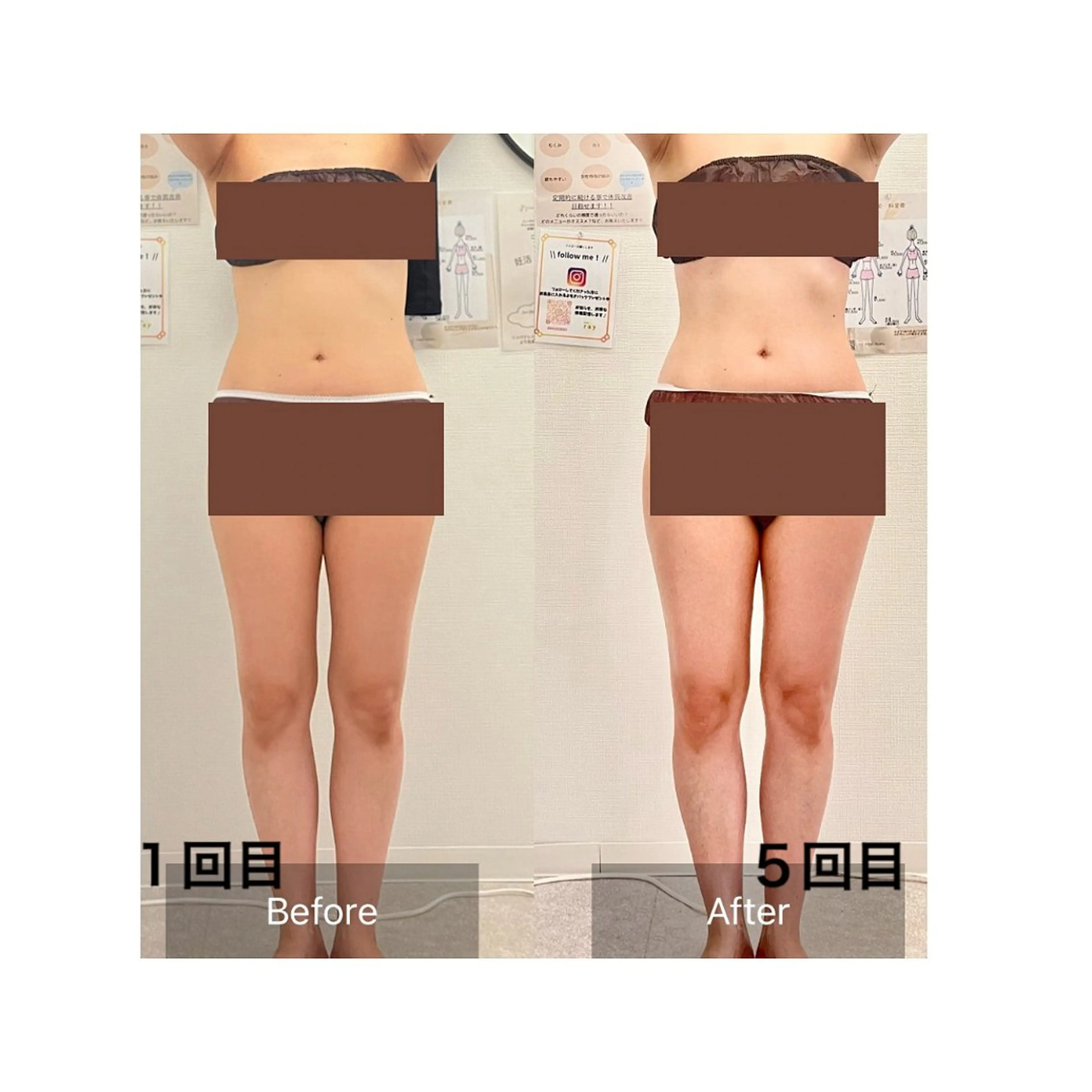 その他 salon ray 痩身／体質改善のエステ・リラクイメージ