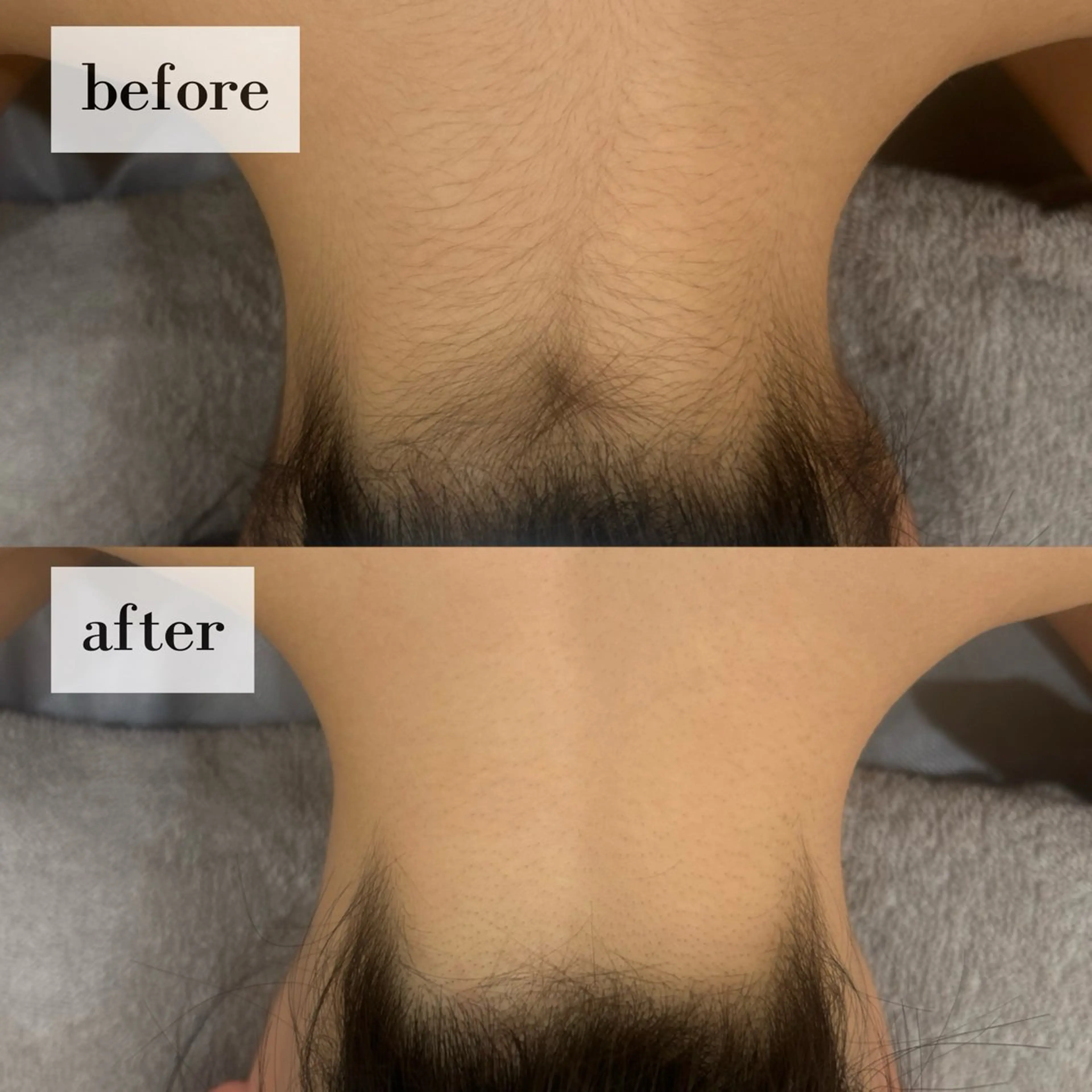 Lyraile所属・-Lyraile - Sahoのエステ・リラクイメージ