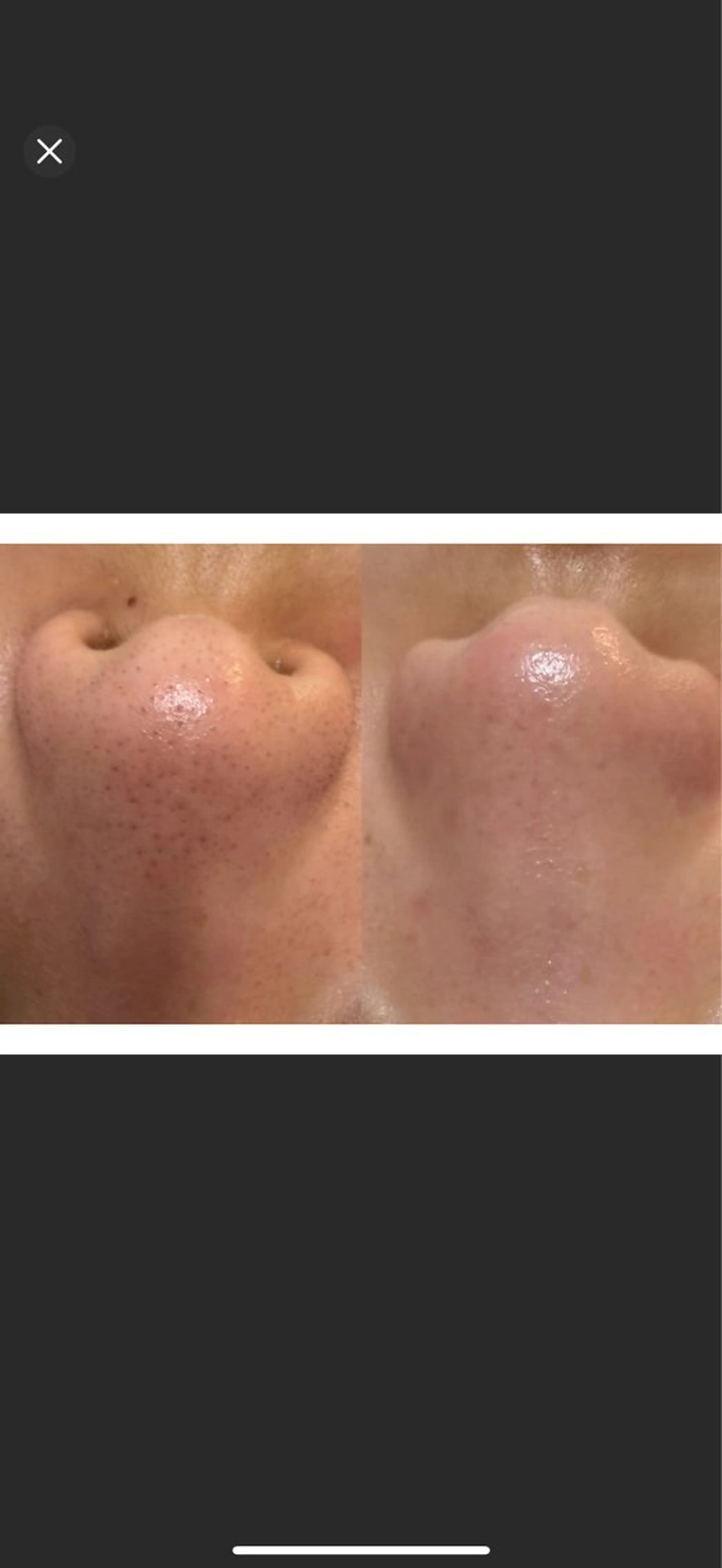 エステ エムズ ビューティスタジオのエステ・リラクイメージ