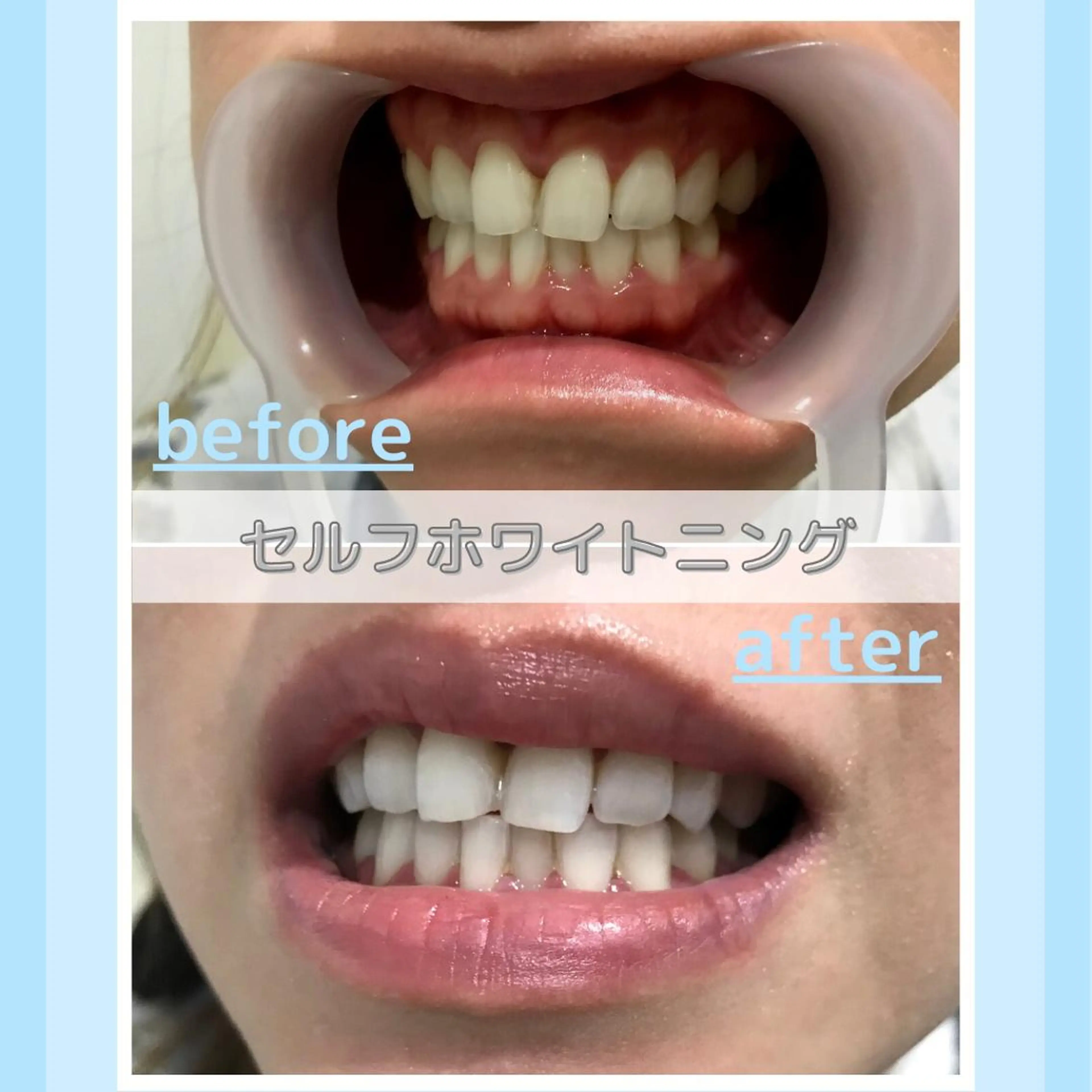 メンズ お手軽ホワイトニングsalon mina所属・武元 奈津美のその他イメージ