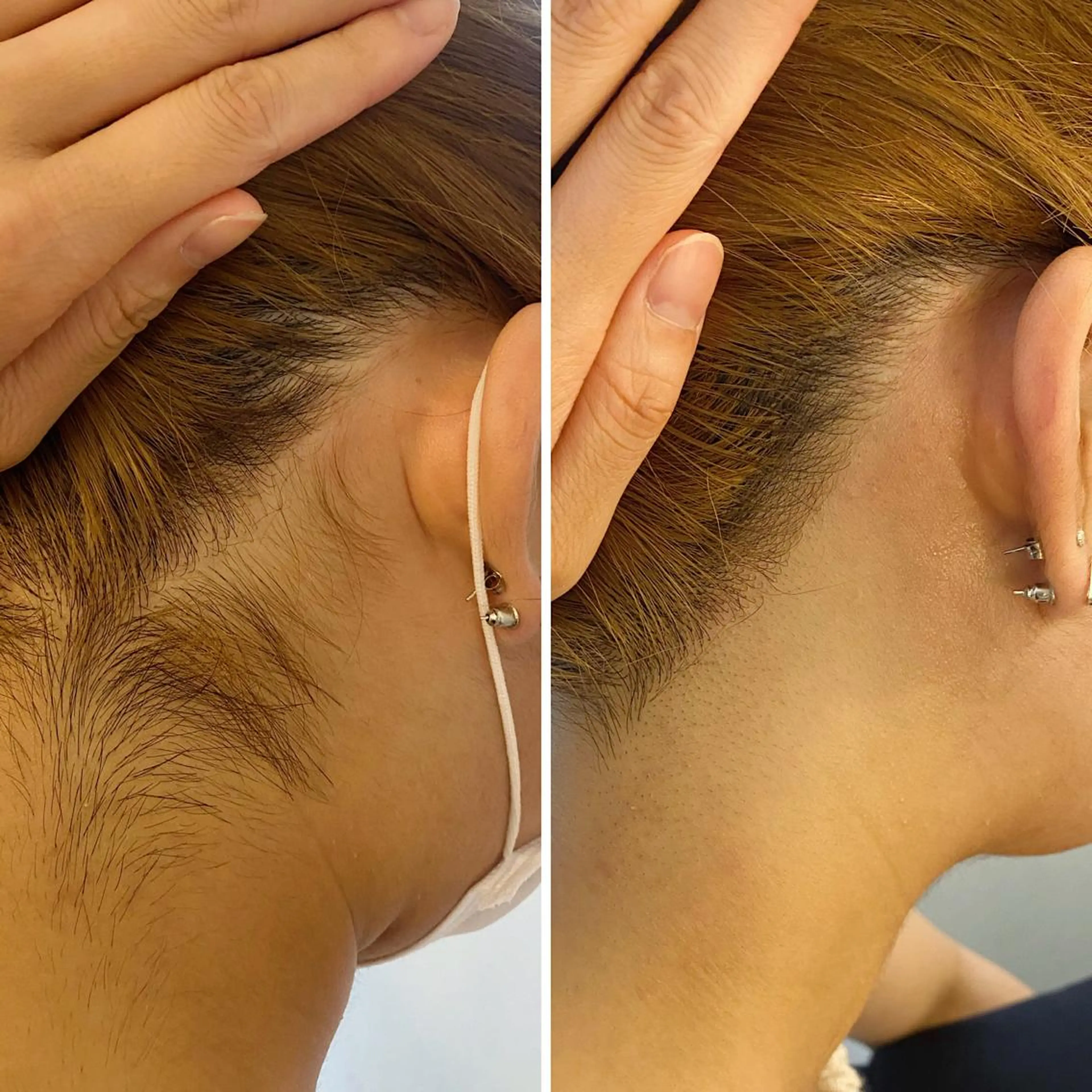 うなじ脱毛/美肌脱毛 LABELのエステ・リラクイメージ