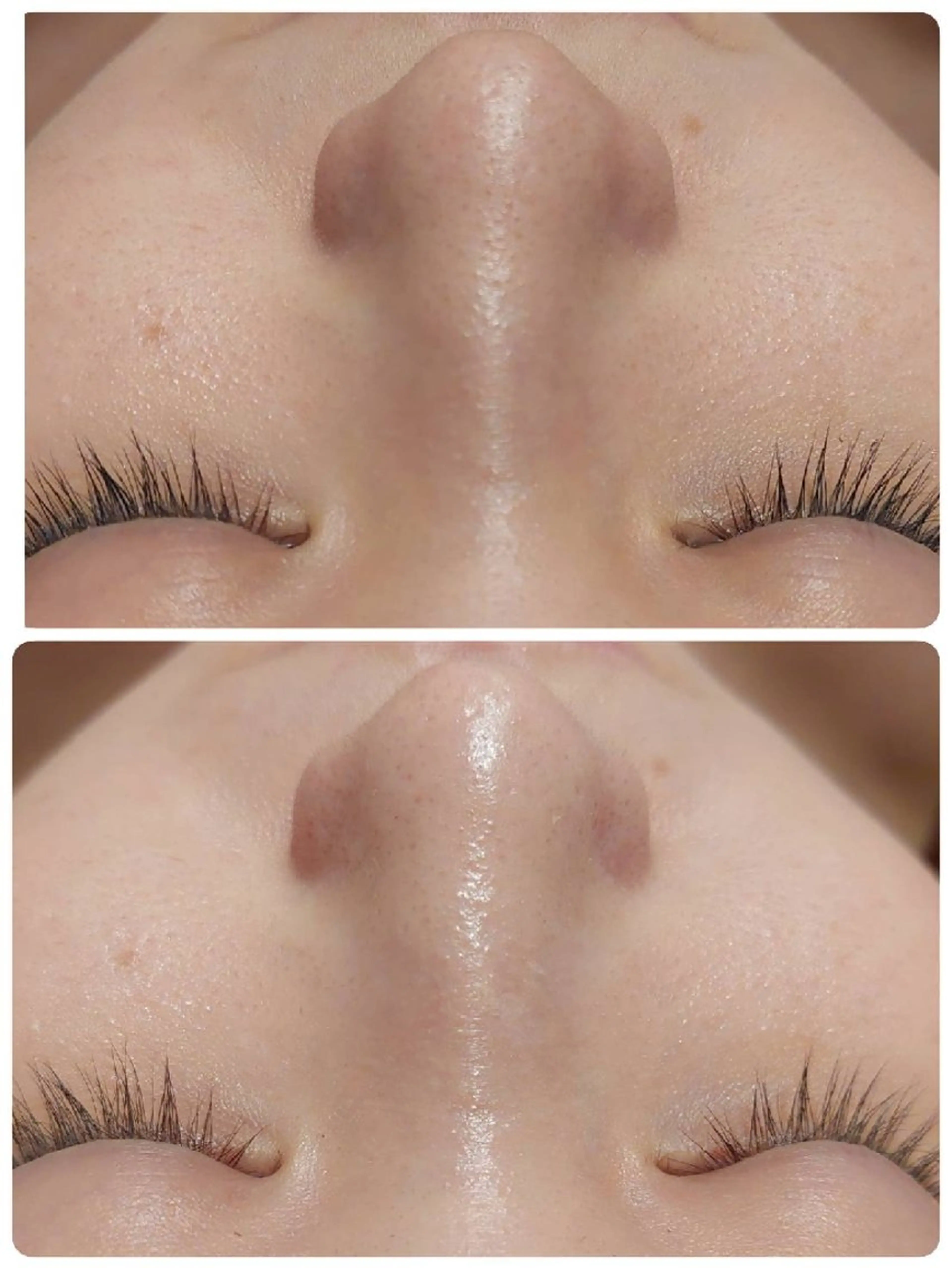 エステ MyFairLady miuのエステ・リラクイメージ