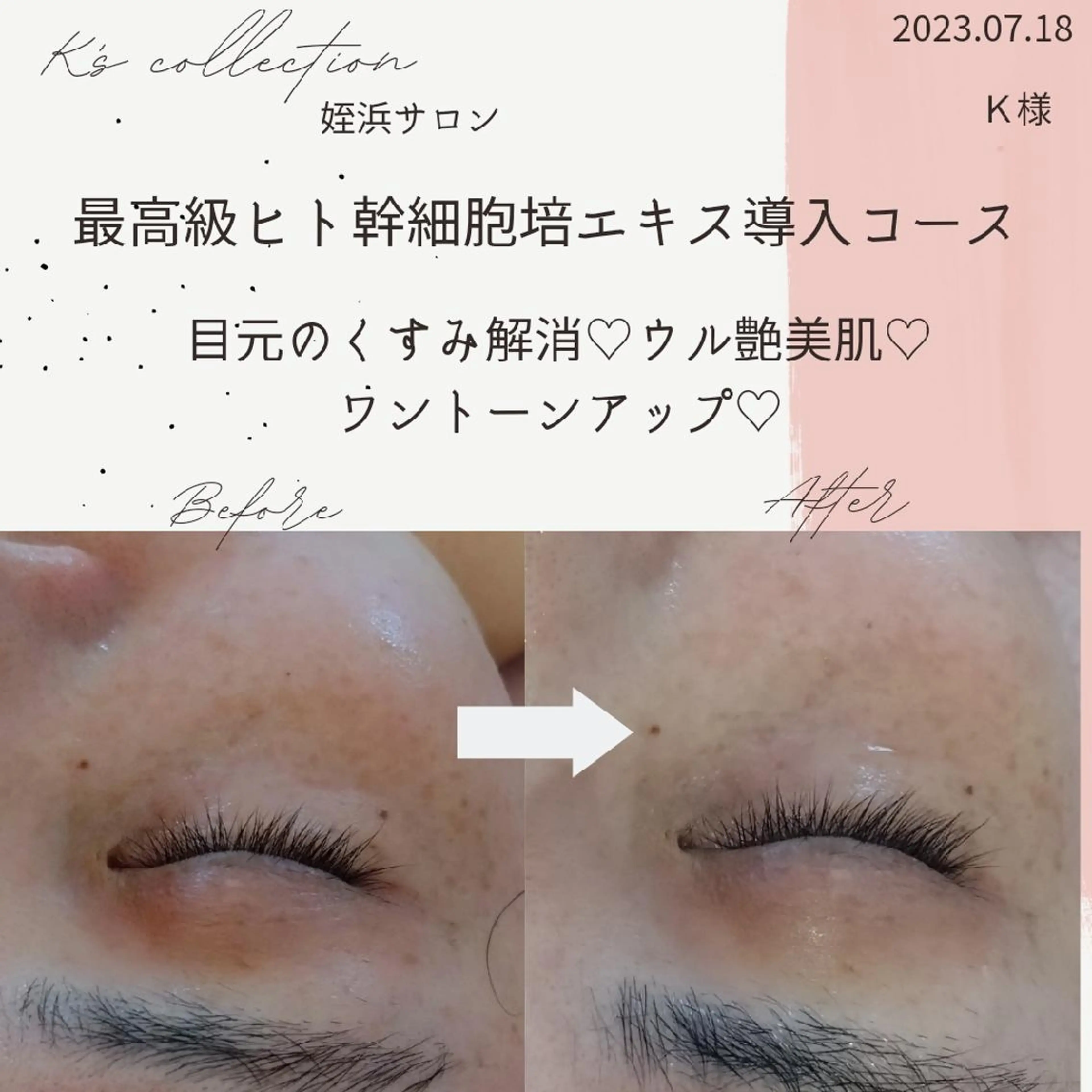 エステ リラク K's姪浜エステ💆 サロン:MAIKOのエステ・リラクイメージ