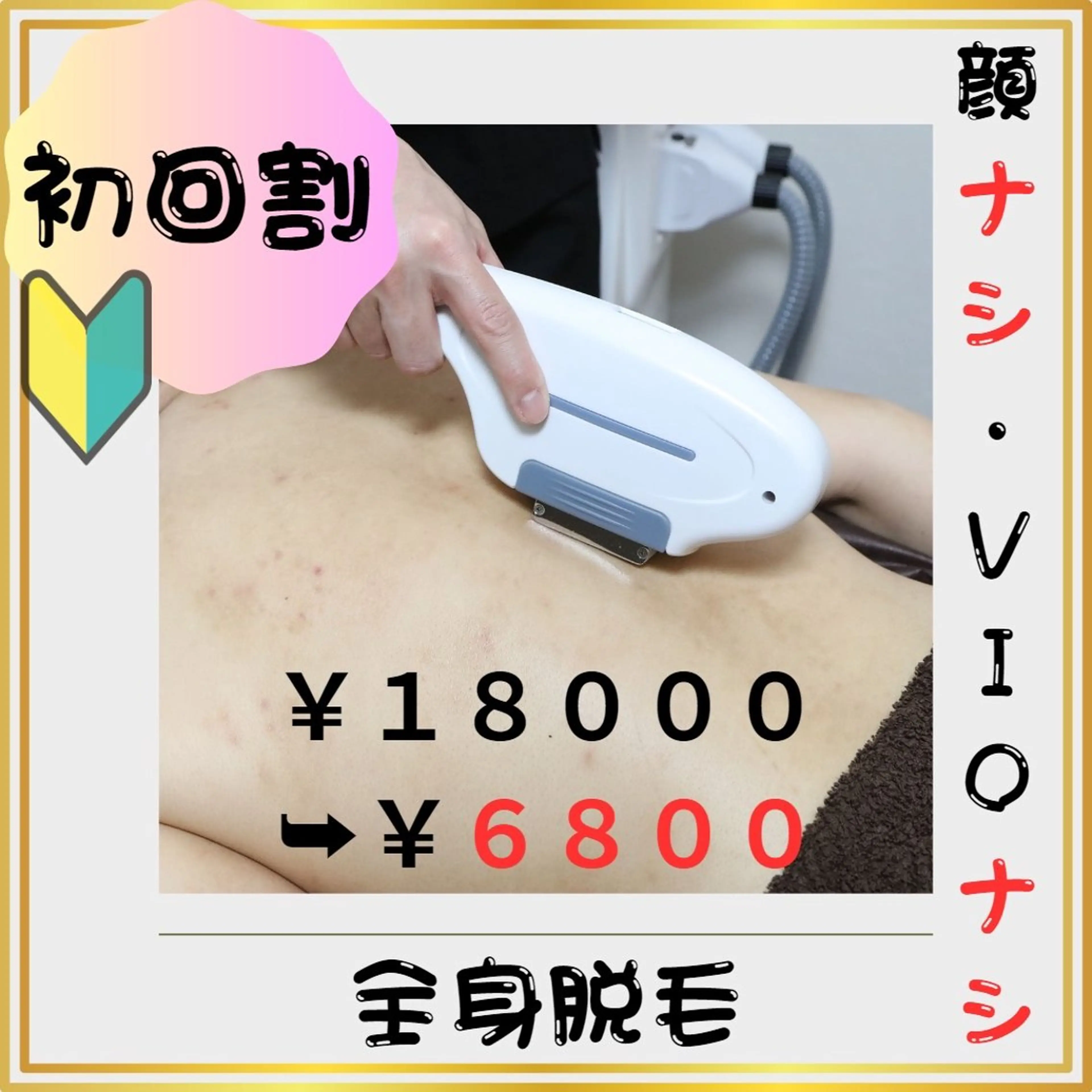 🔰新規割🔰【全身脱毛（顔無・VIO無）】 6️⃣2️⃣%割引❗️(#メンズ脱毛 　#第一印象UP  #都度払い)の写真