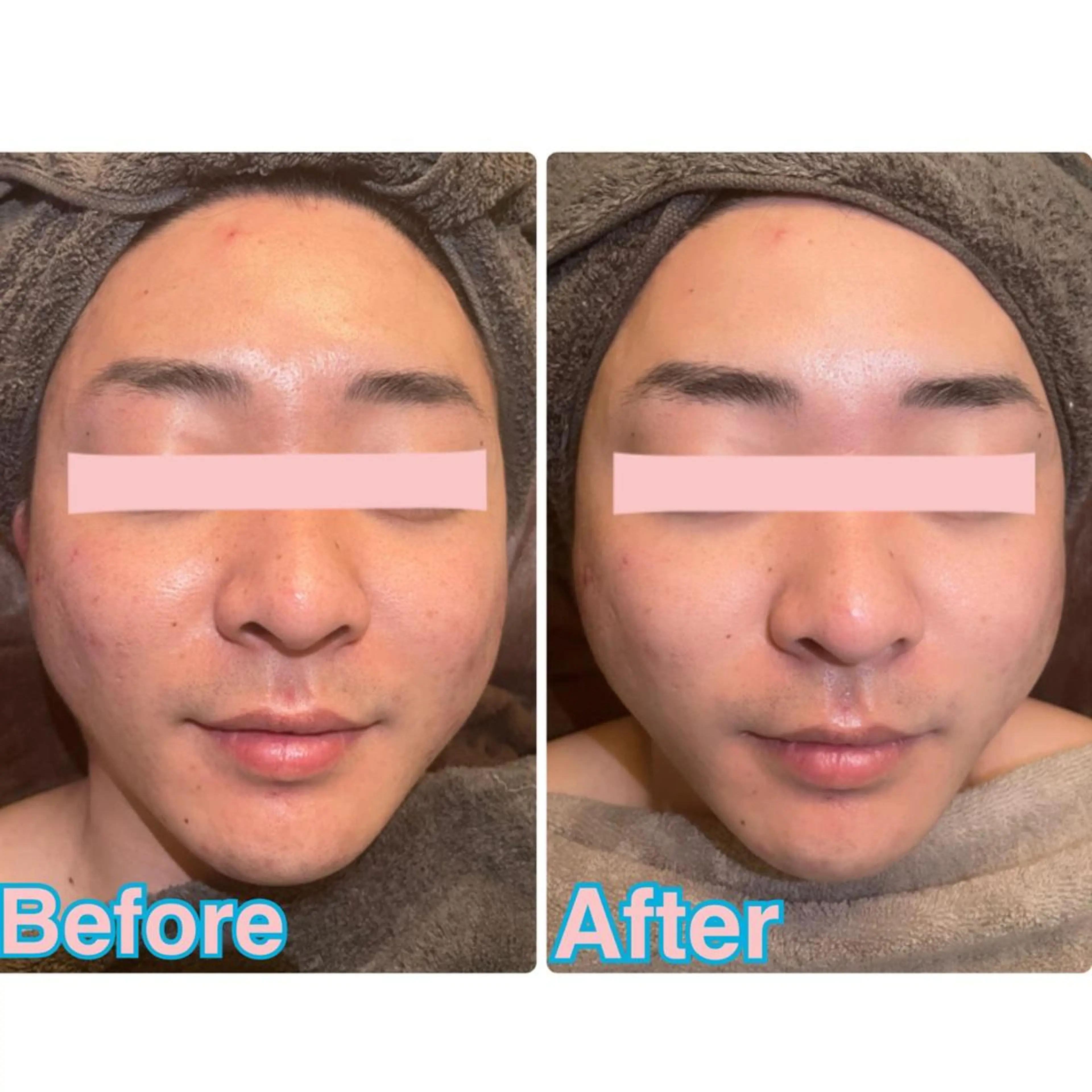 Beauty  Salon Twinkle所属・渡部 奈桜のエステ・リラクイメージ