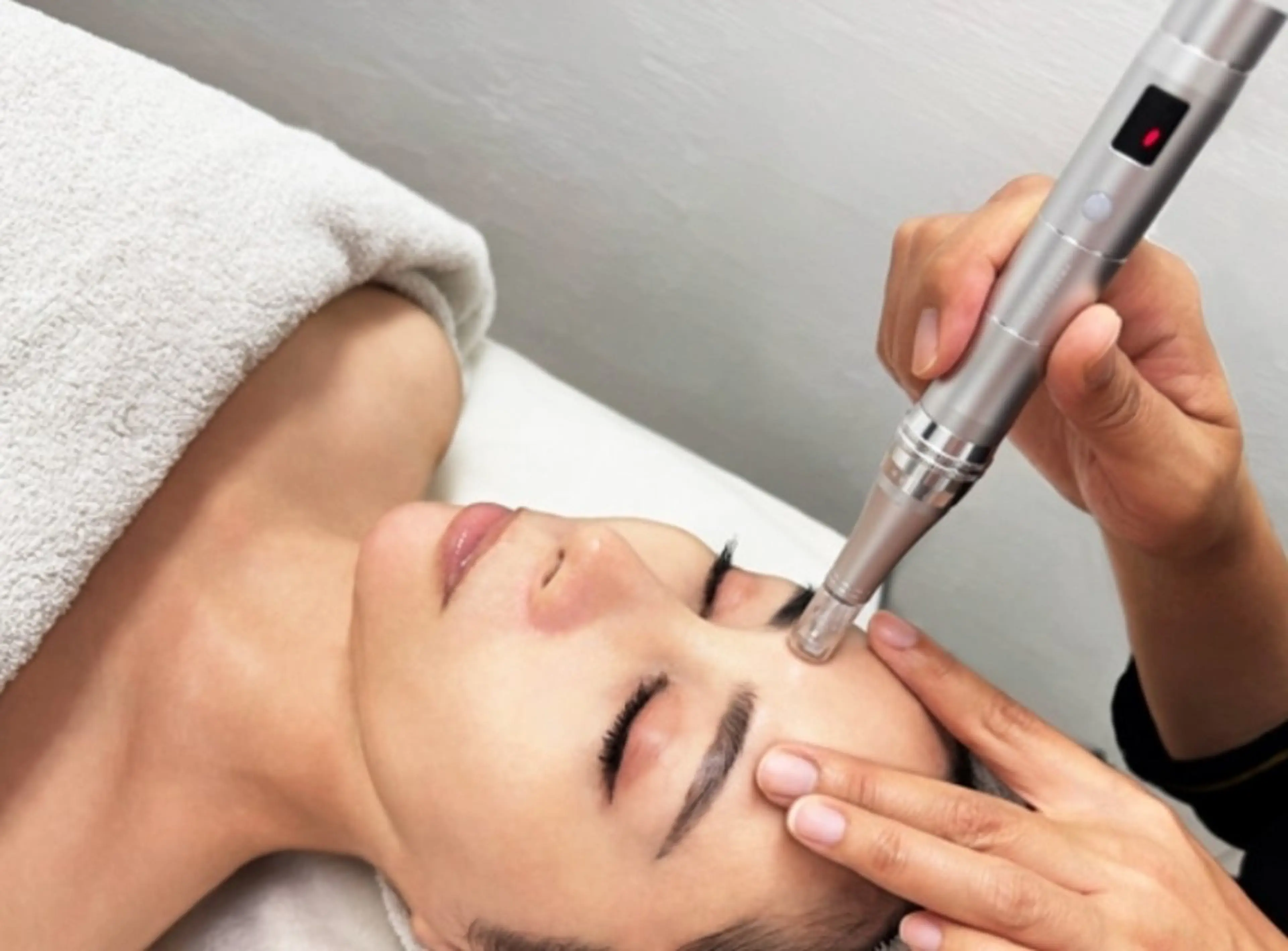 【韓国艶玉肌☆】ソフトピーリング×エステダーマ生美容液導入の写真