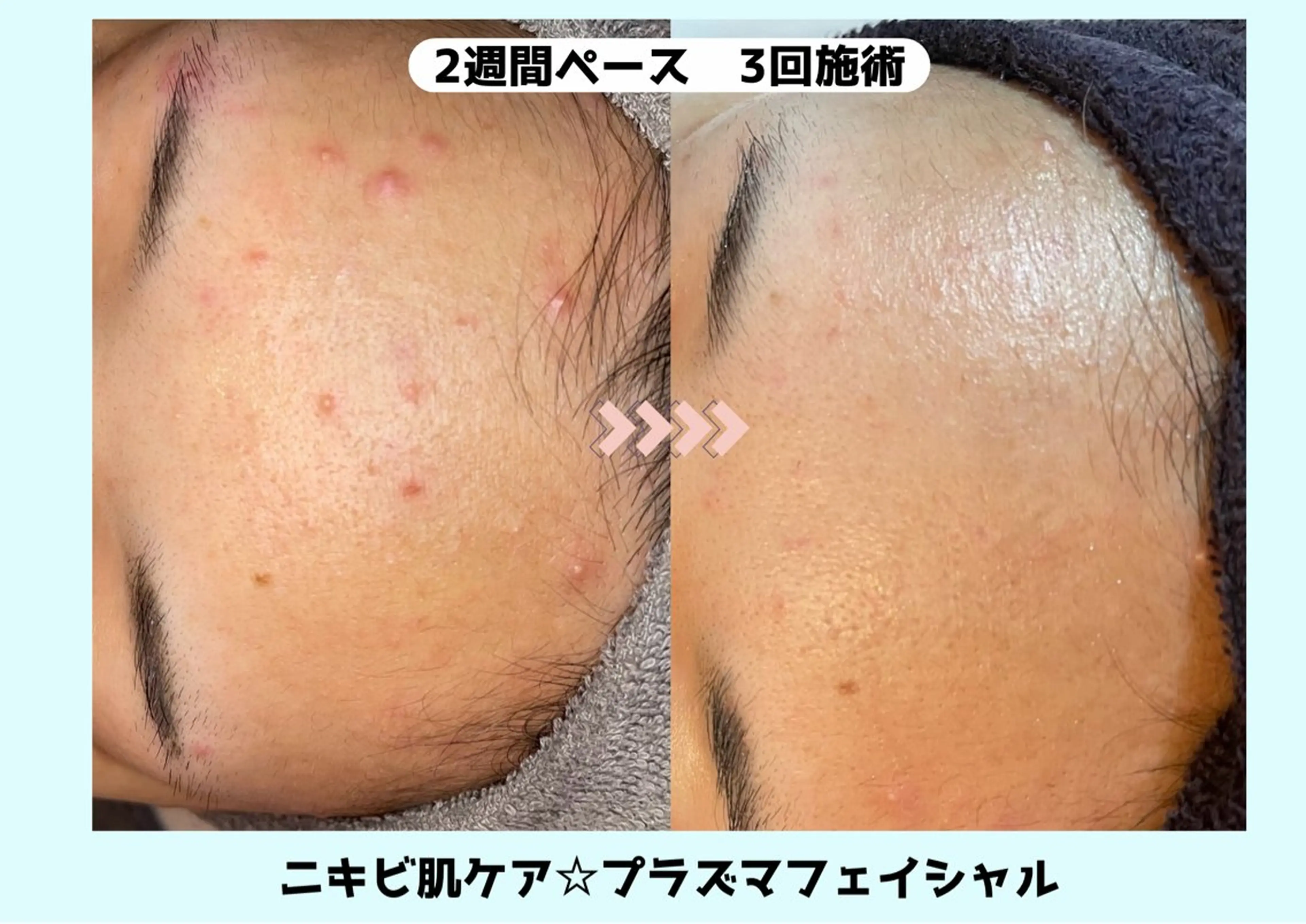 エステ Babel 〜都度払いサロン〜のエステ・リラクイメージ