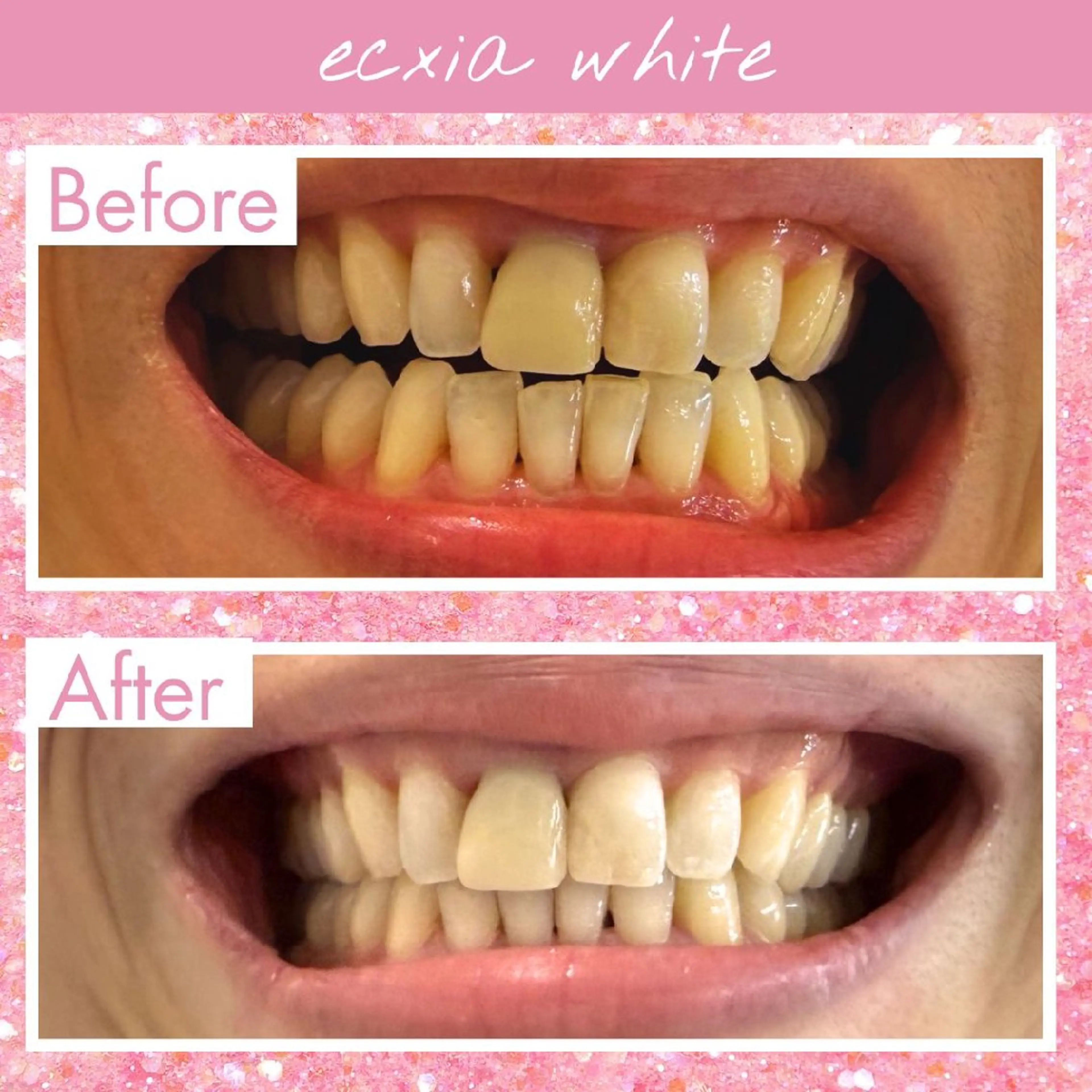 セルフホワイトニングエクシアホワイト草加店所属・セルフホワイトニング エクシア草加店のその他イメージ