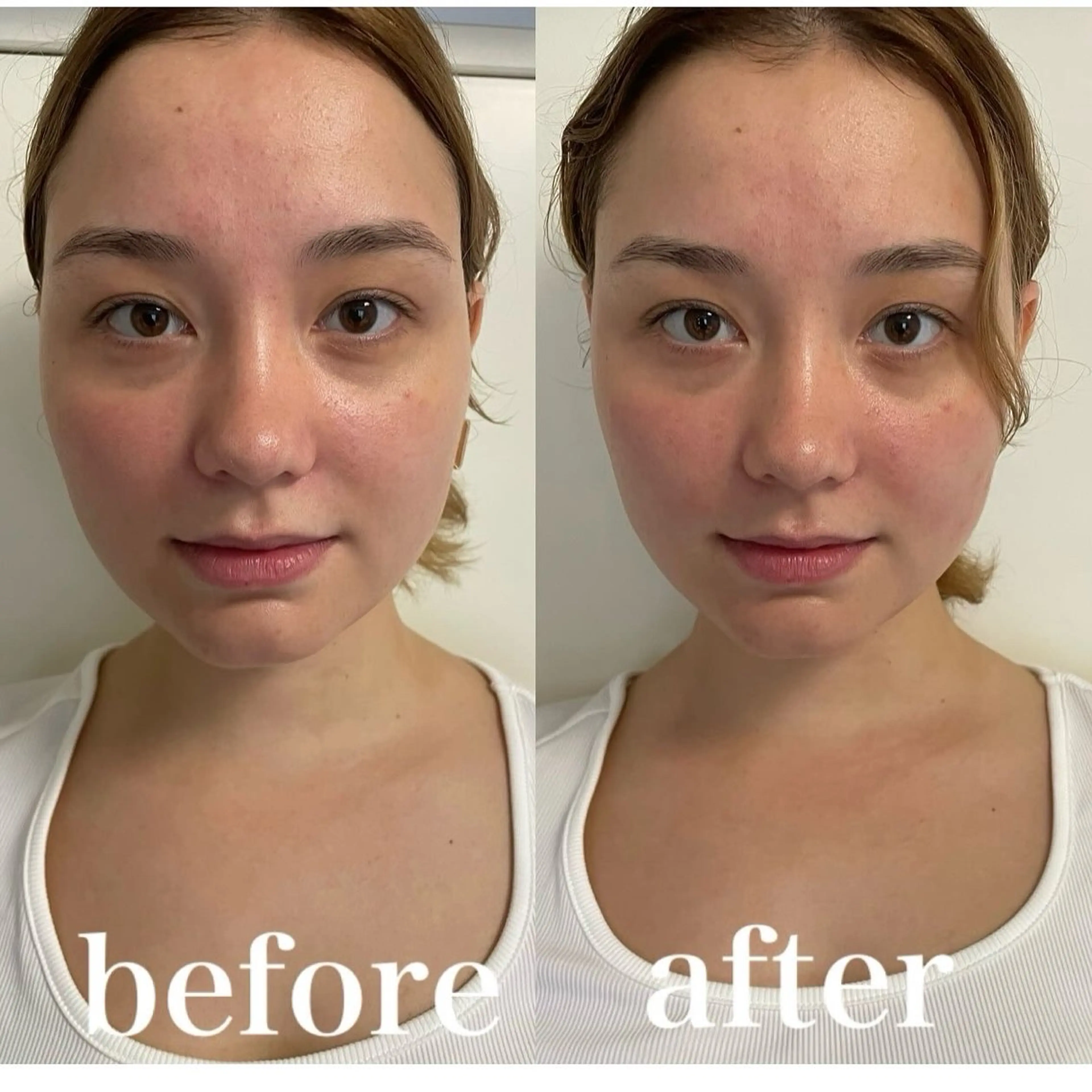 美容鍼灸サロン mahoroba院長のエステ・リラクイメージ