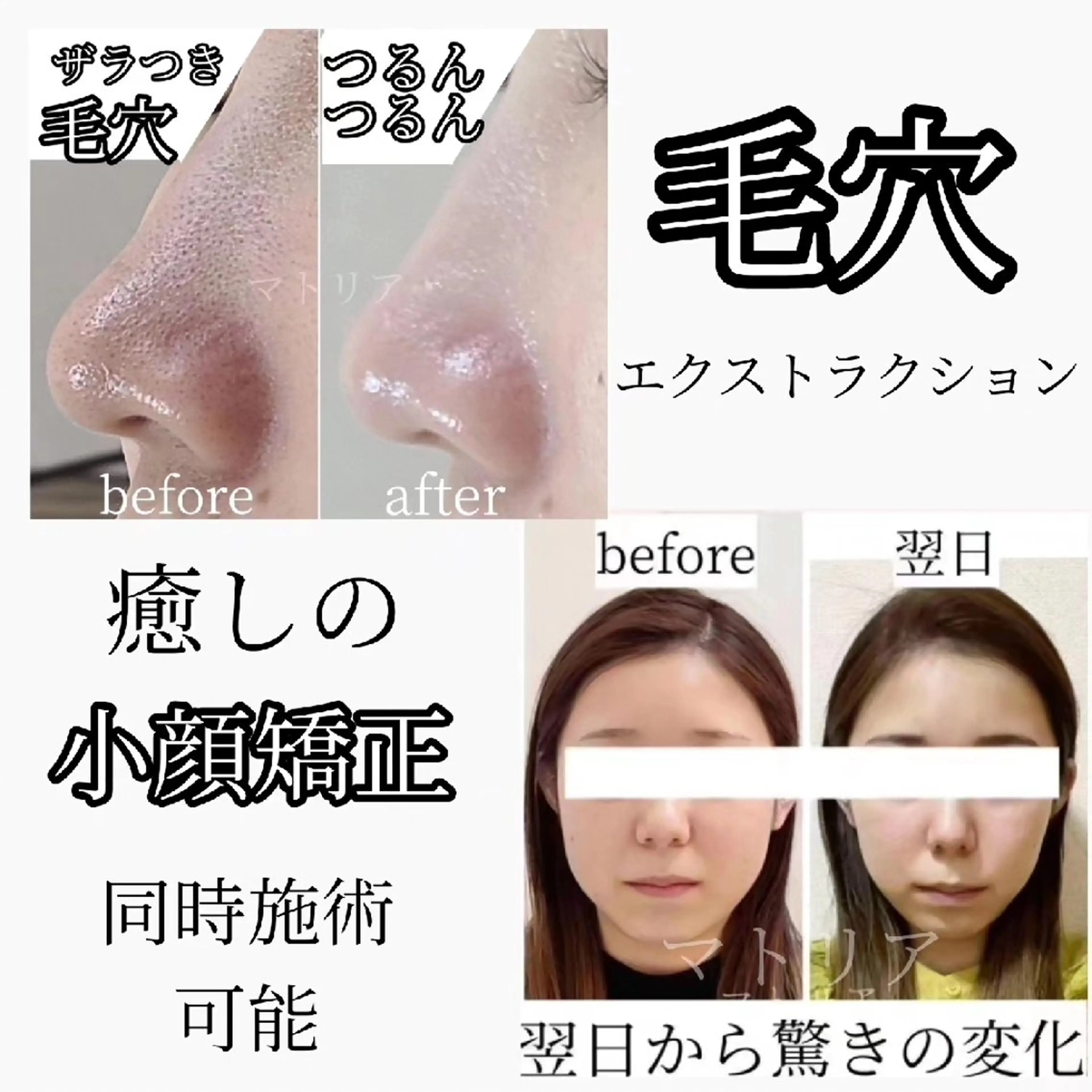 小顔と美肌 まごころエステMatoria所属・小顔 美肌専門 Matoriaのエステ・リラクイメージ