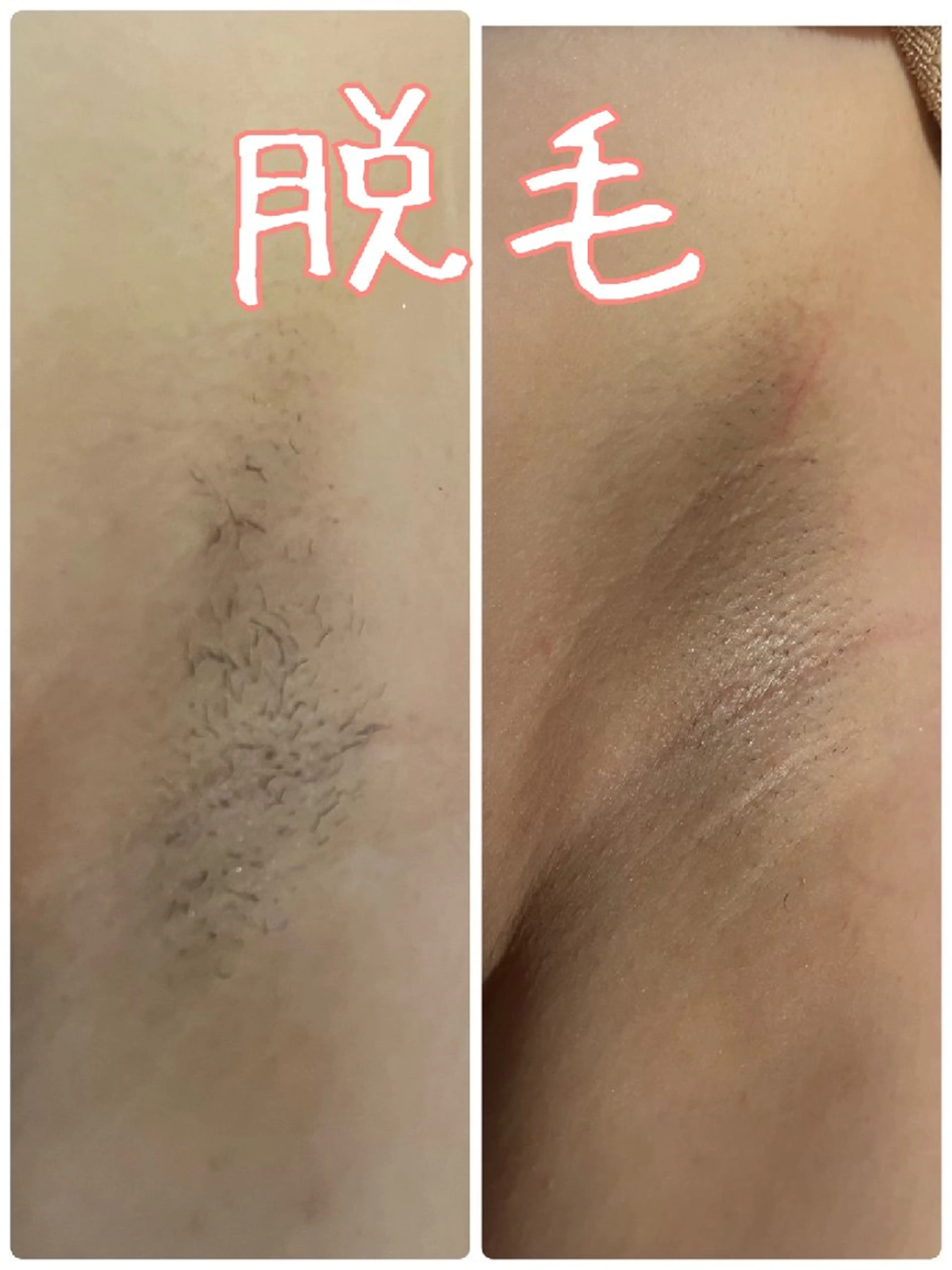 脱毛 エステsala藤沢 sanaeのエステ・リラクイメージ