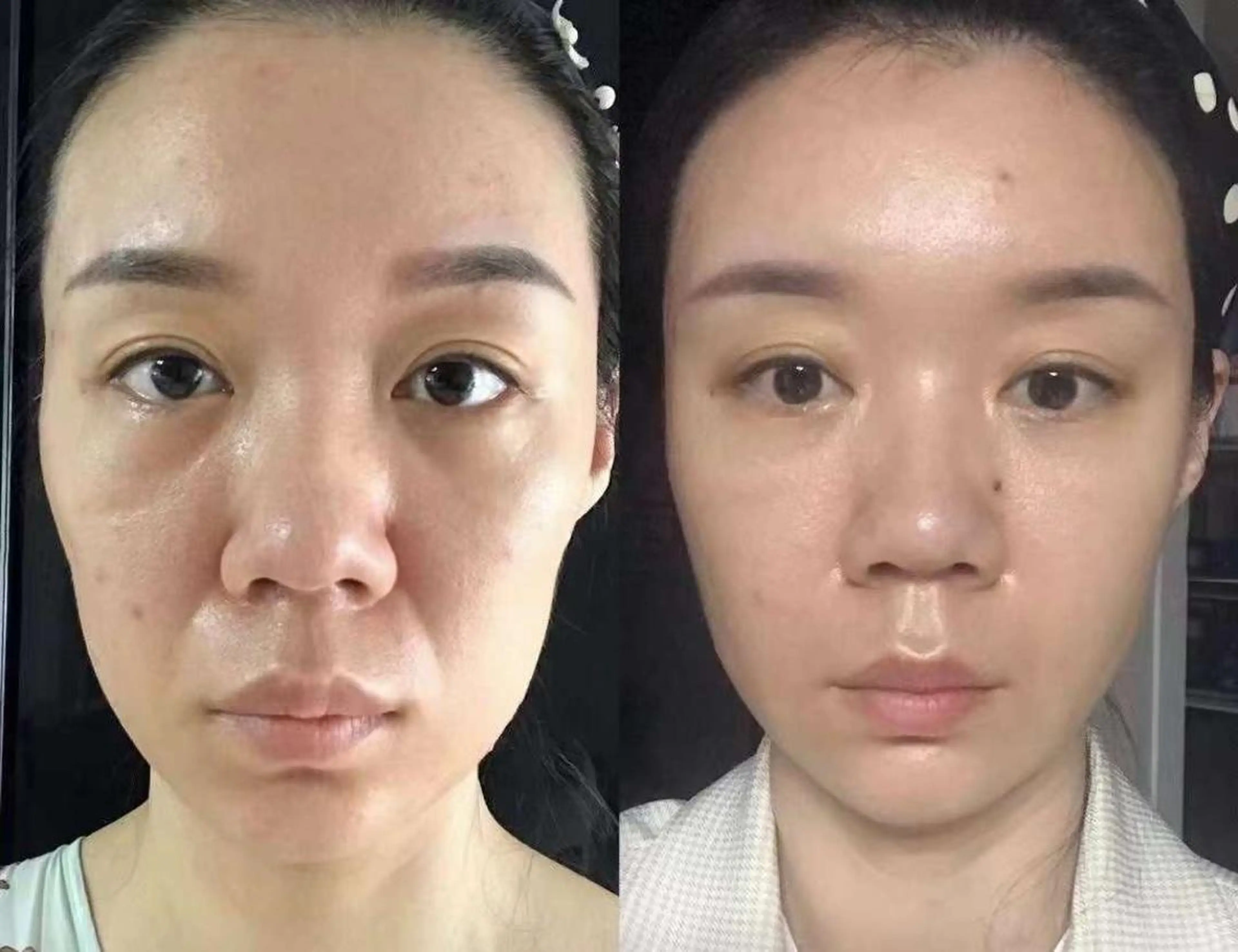 エステ aliaハイフ&水光ジェットサロン所属・aliaハーブ水光店 エステティシャン募集のエステ・リラクイメージ