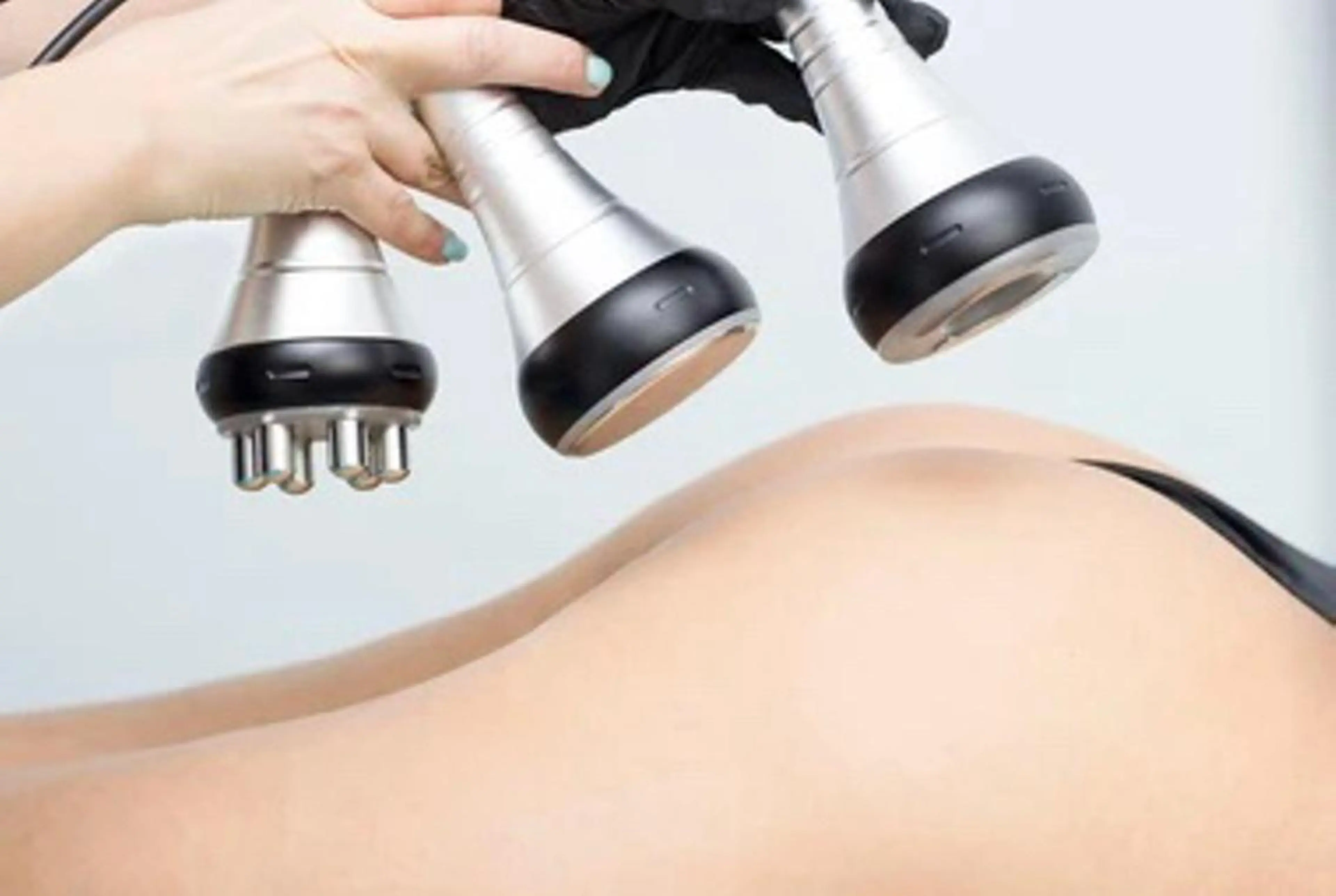 ❤️痩身 キャビテーション/ラジオ波/EMS 秋冬の間に痩せるキャンペーン🍂🎄❤️ふくらはぎ&太ももの写真