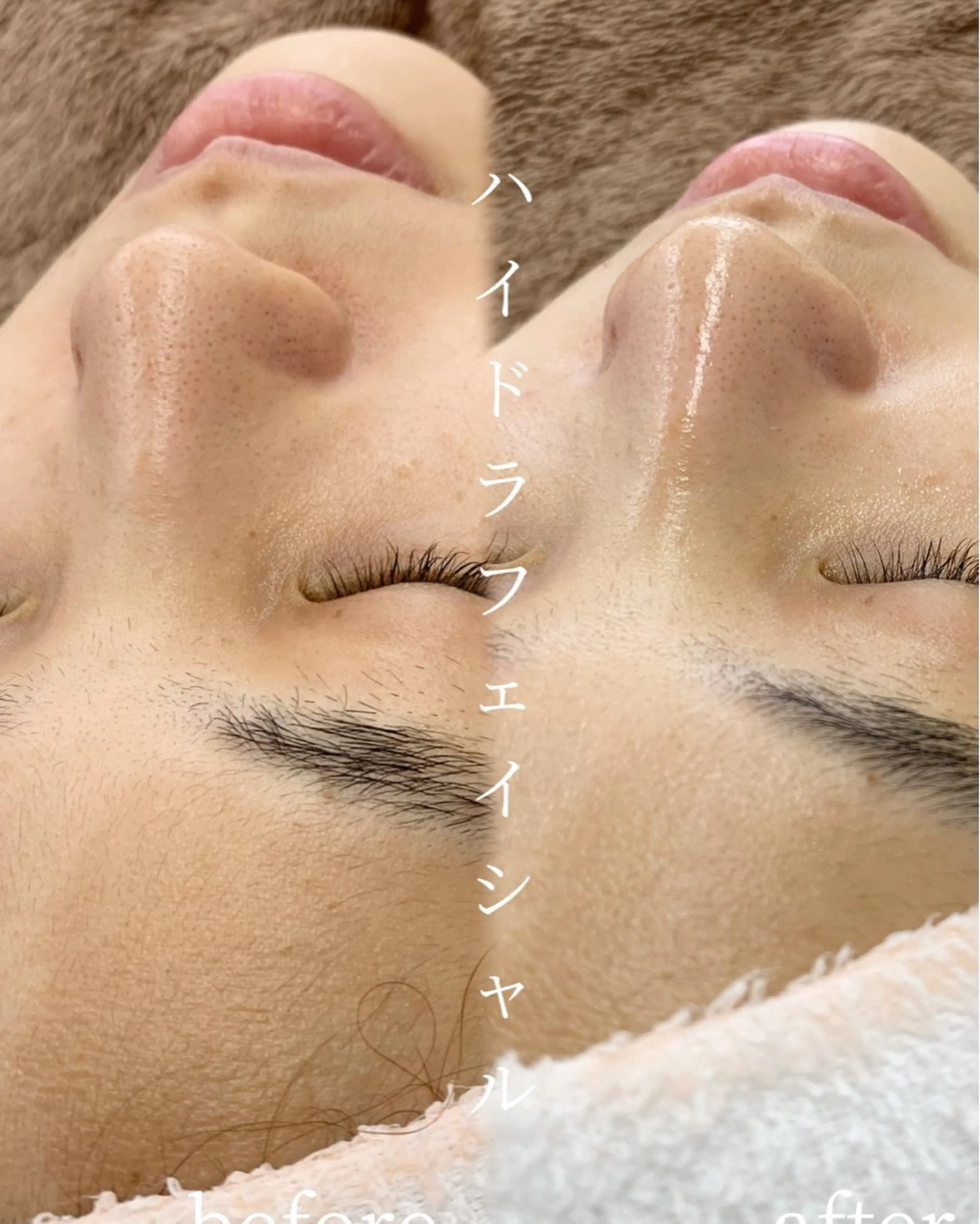 エステ リラク lifra CHISAのマツエク・マツパデザイン