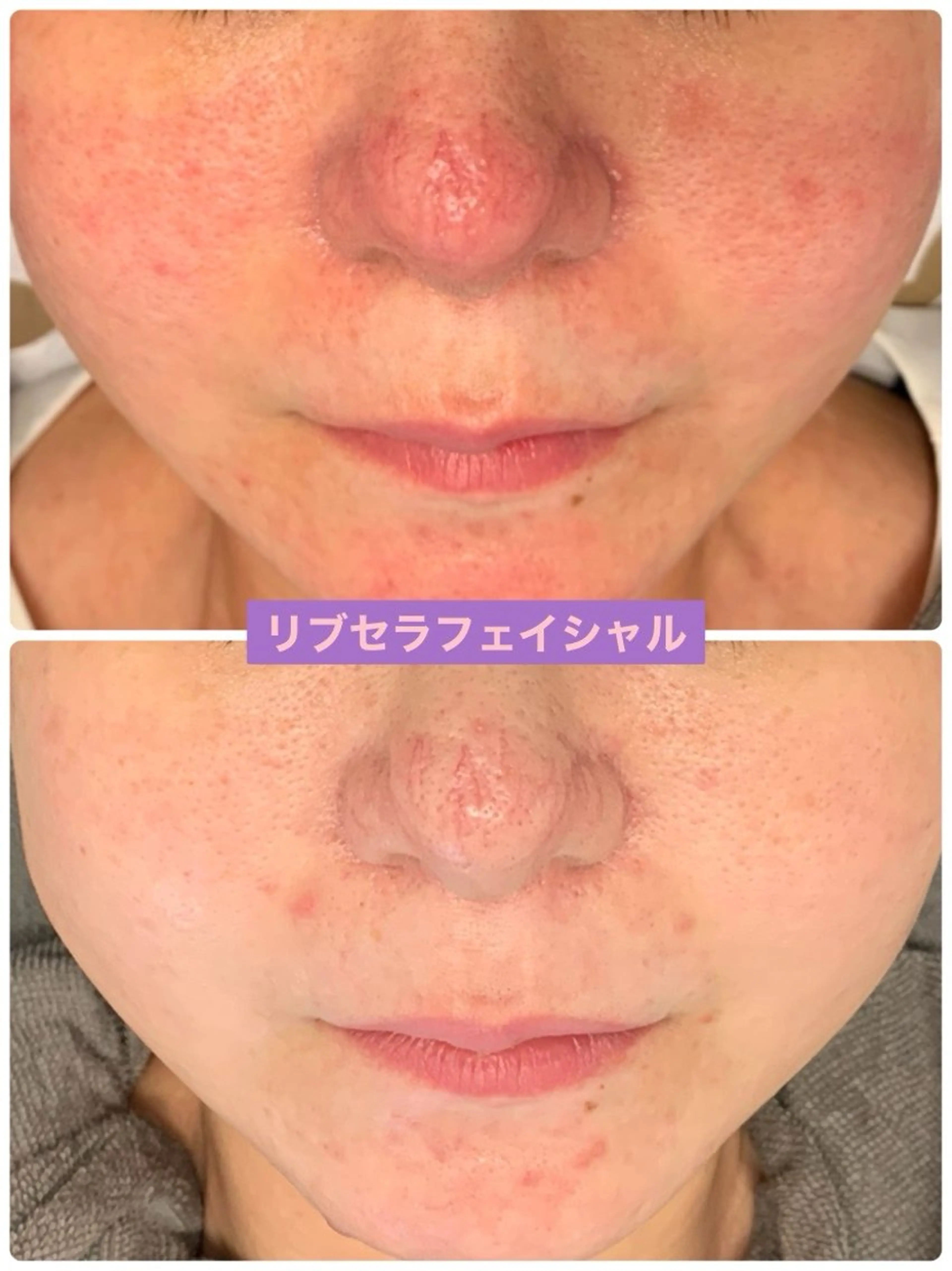 エステ Private Salon Prunelle所属・プライベートサロン プリュネルのエステ・リラクイメージ