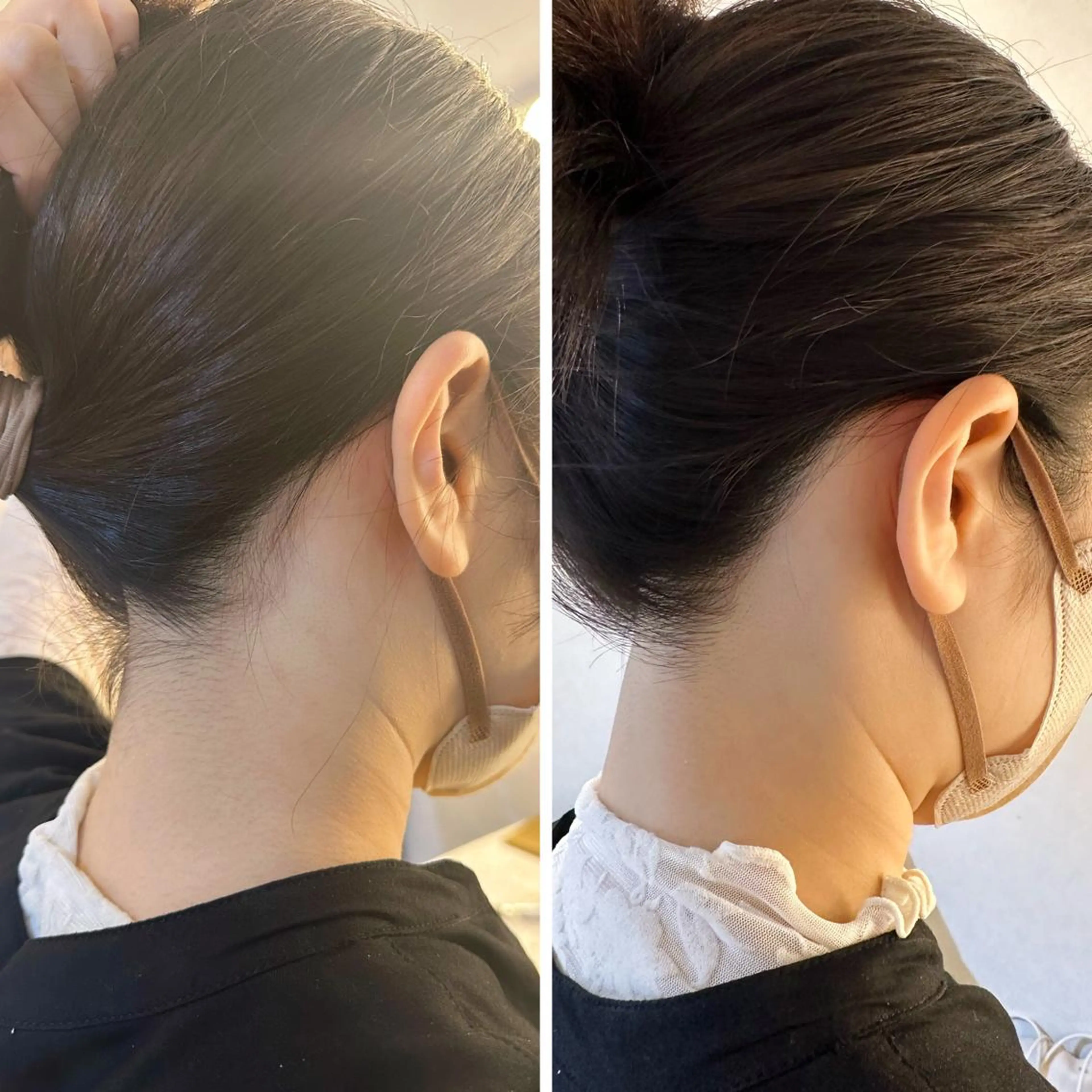 脱毛 うなじ脱毛/美肌脱毛 LABELのエステ・リラクイメージ