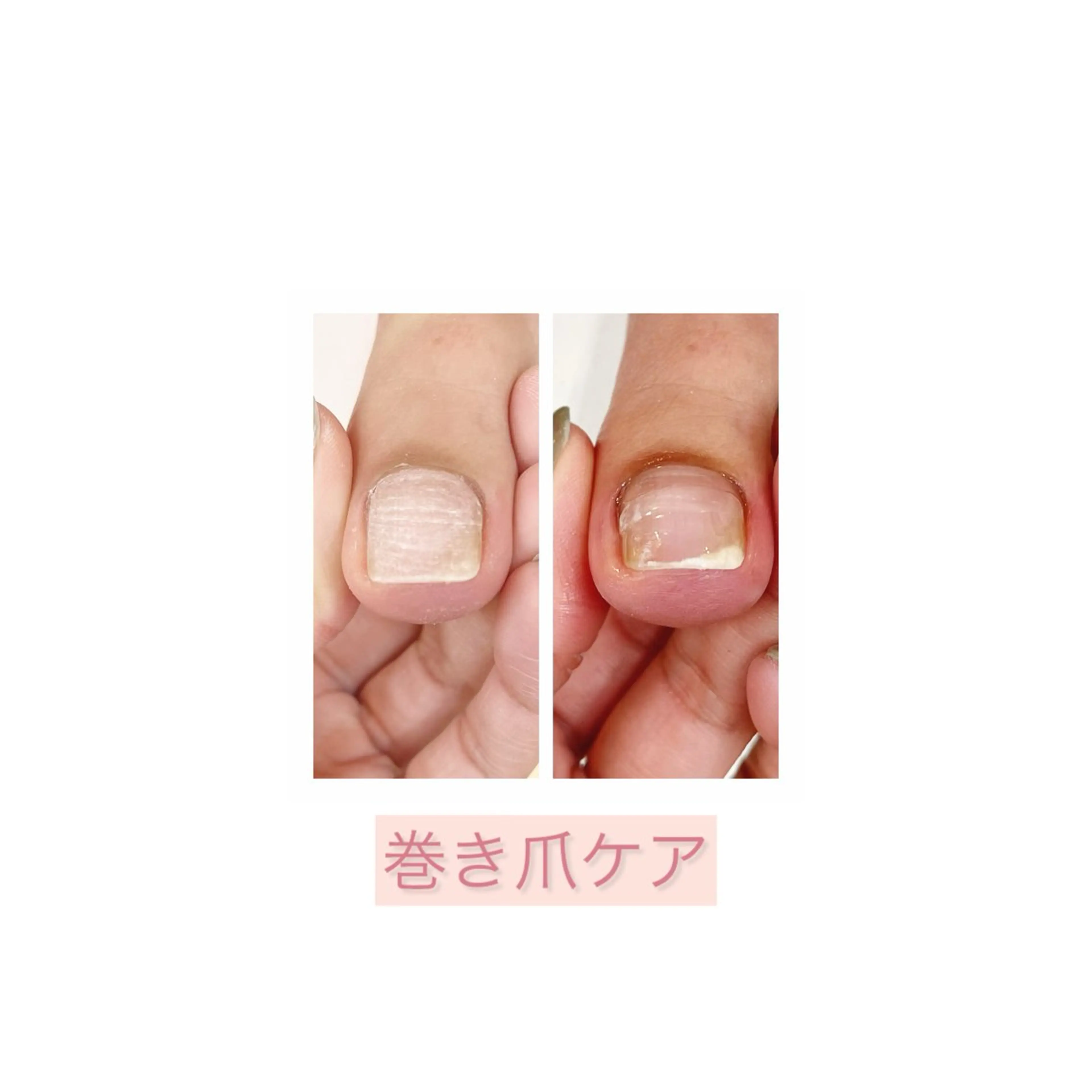 その他(ネイル) Bella  totalbeauty所属・Bella 齋藤理奈のネイルデザイン