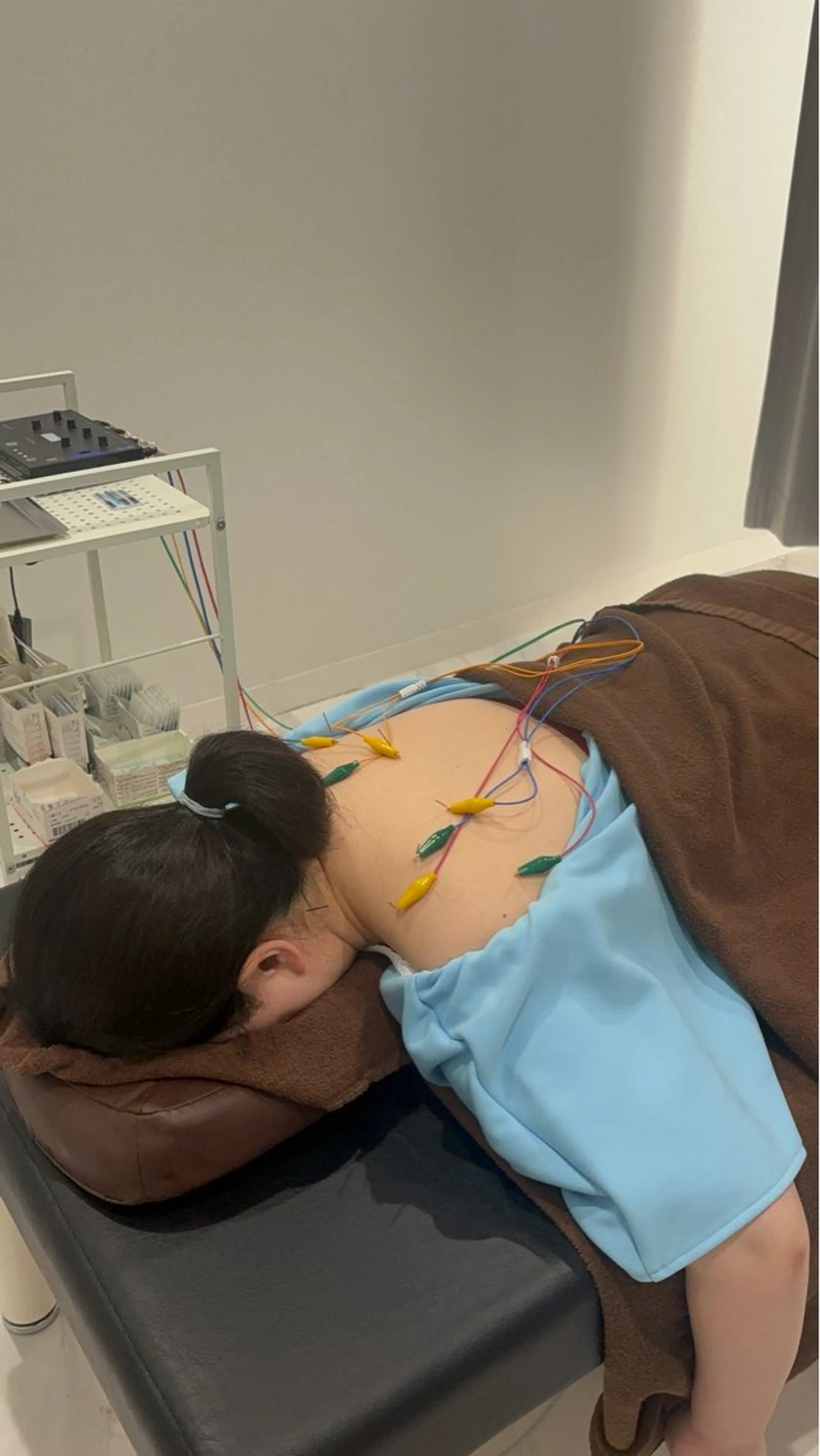 80分メニュー(美容鍼、整体、マッサージ)の写真