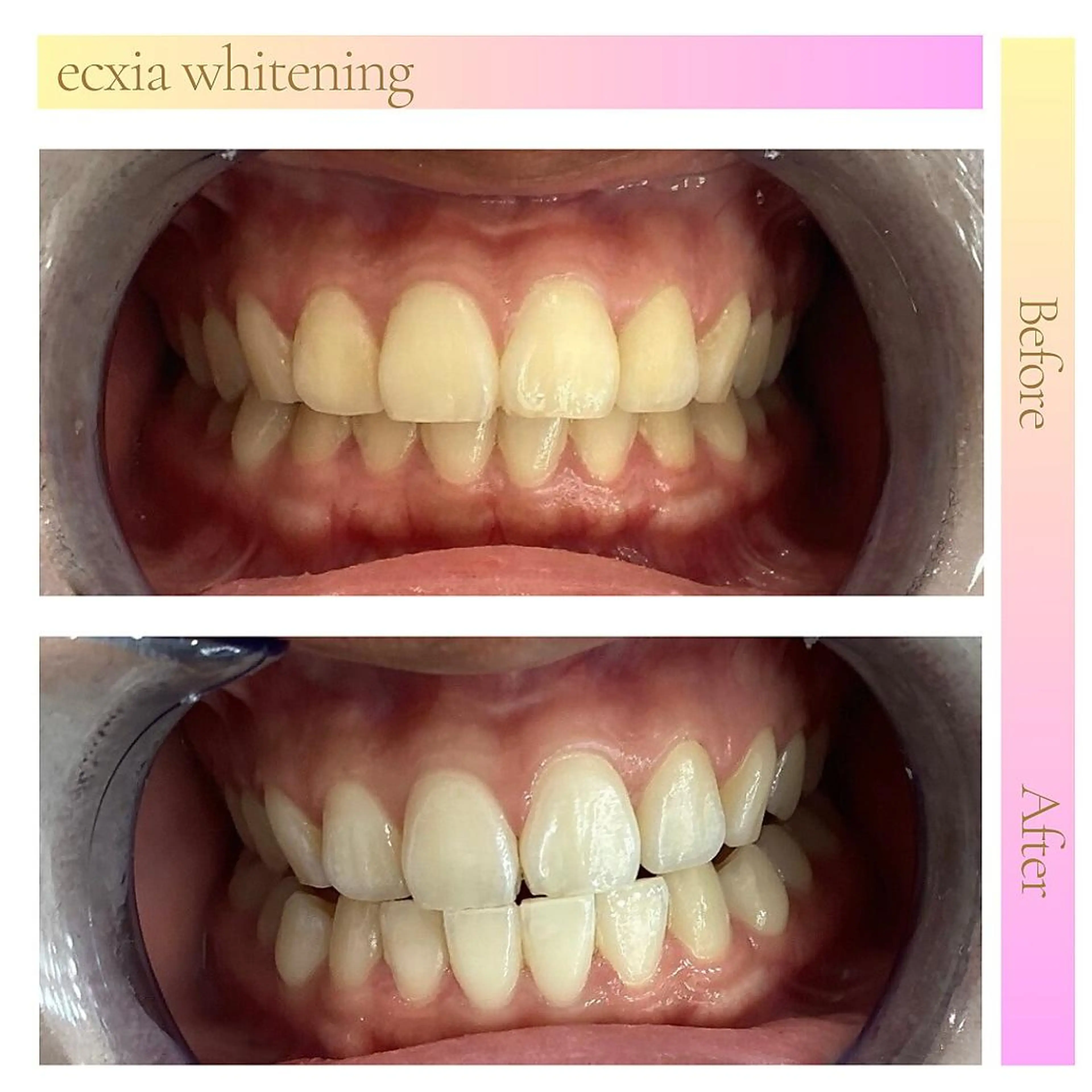 その他 セルフホワイトニング エクシア　京都四条店のその他イメージ