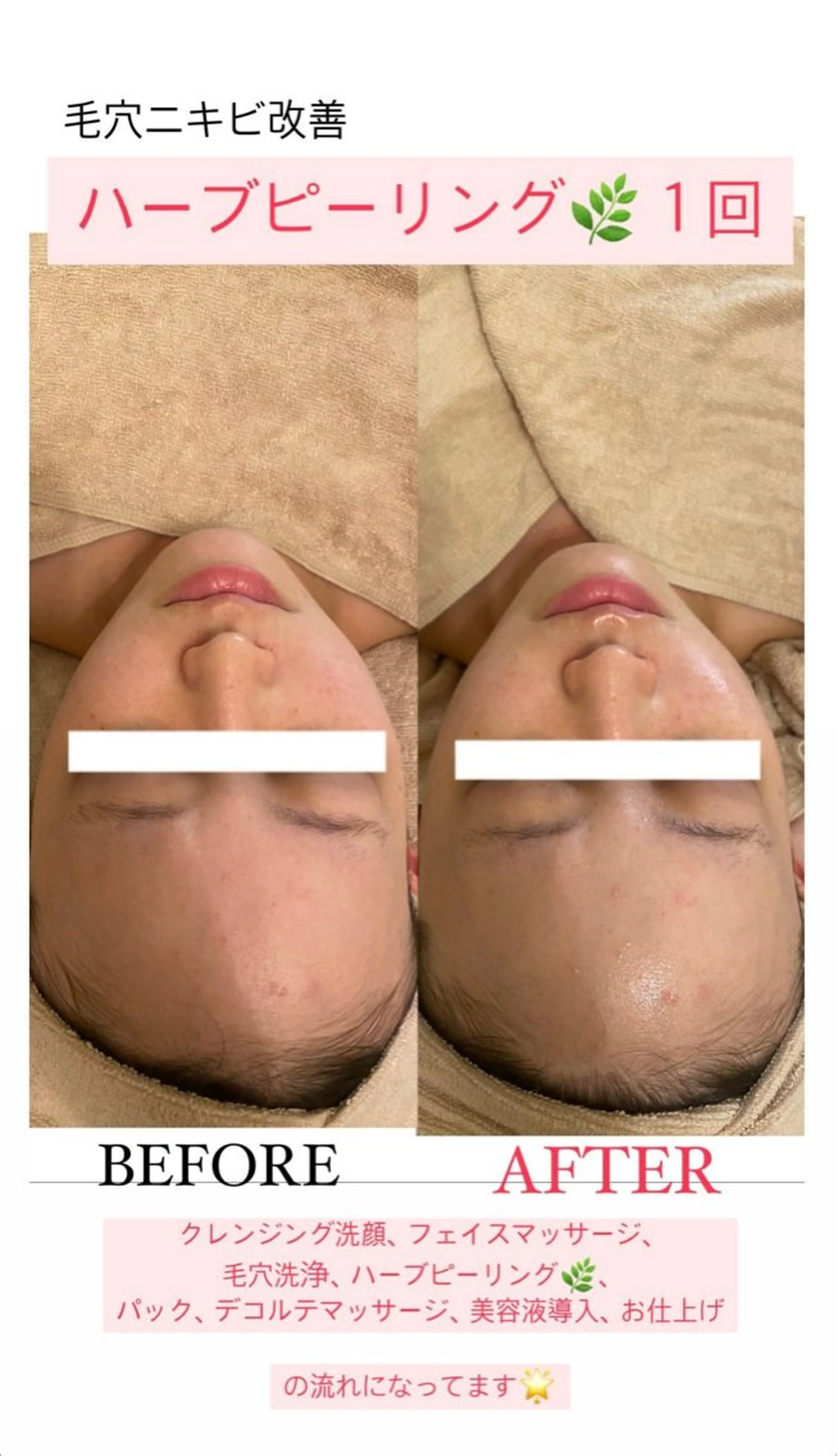 エステ Salon de Lino 御器所のエステ・リラクイメージ