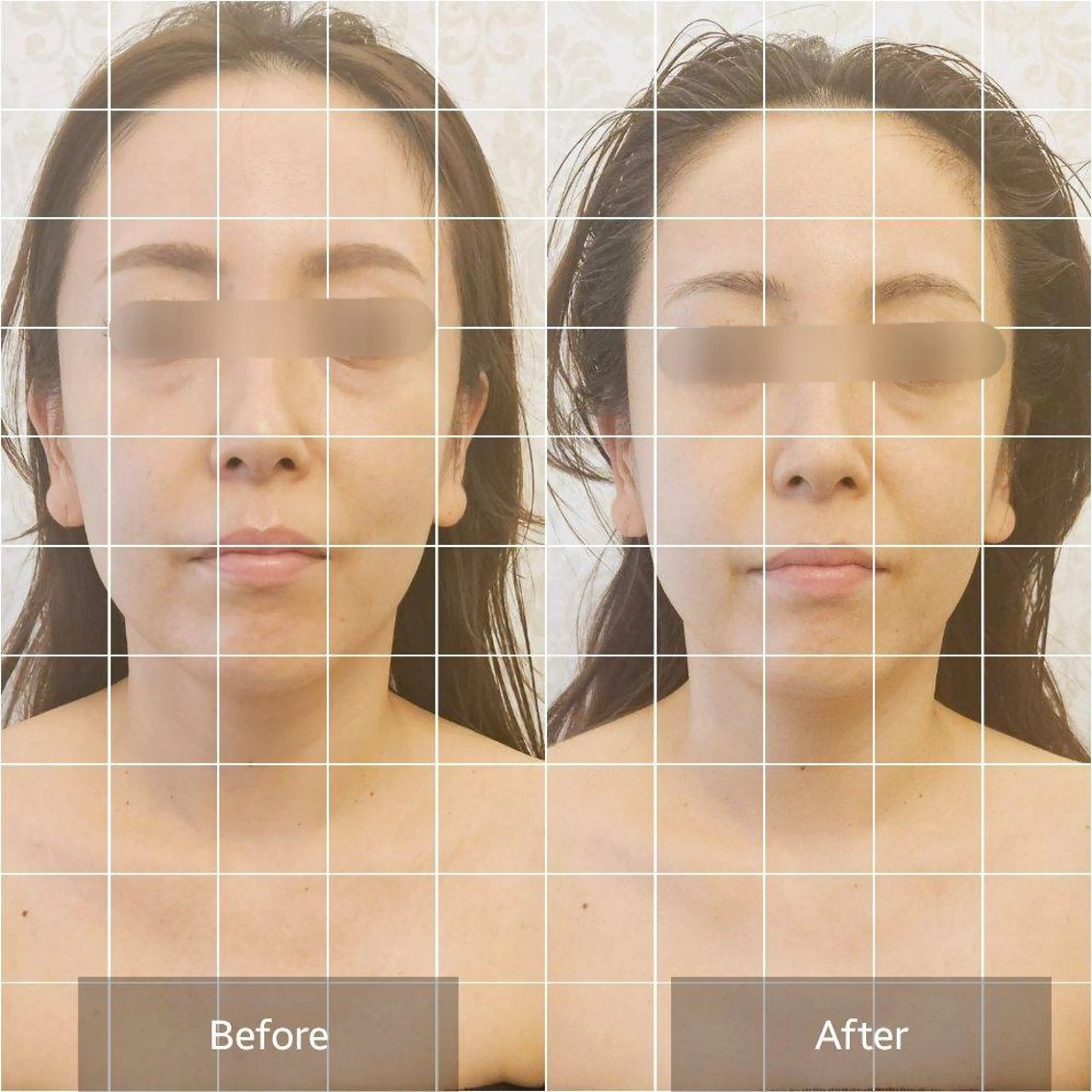 小顔・美肌ケア専門 Diva北浜のエステ・リラクイメージ