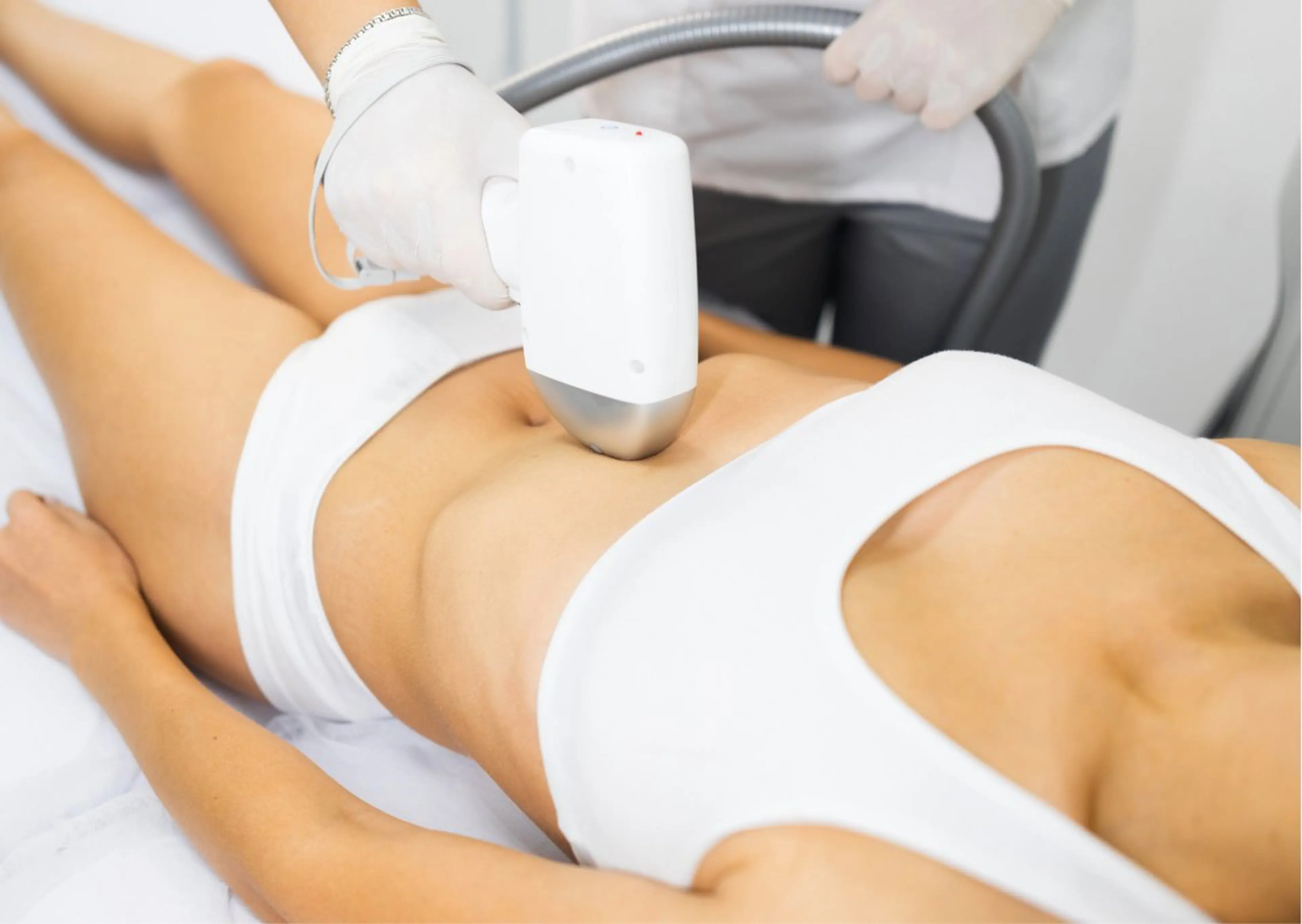 全身脱毛(VIO・顔込み)の写真