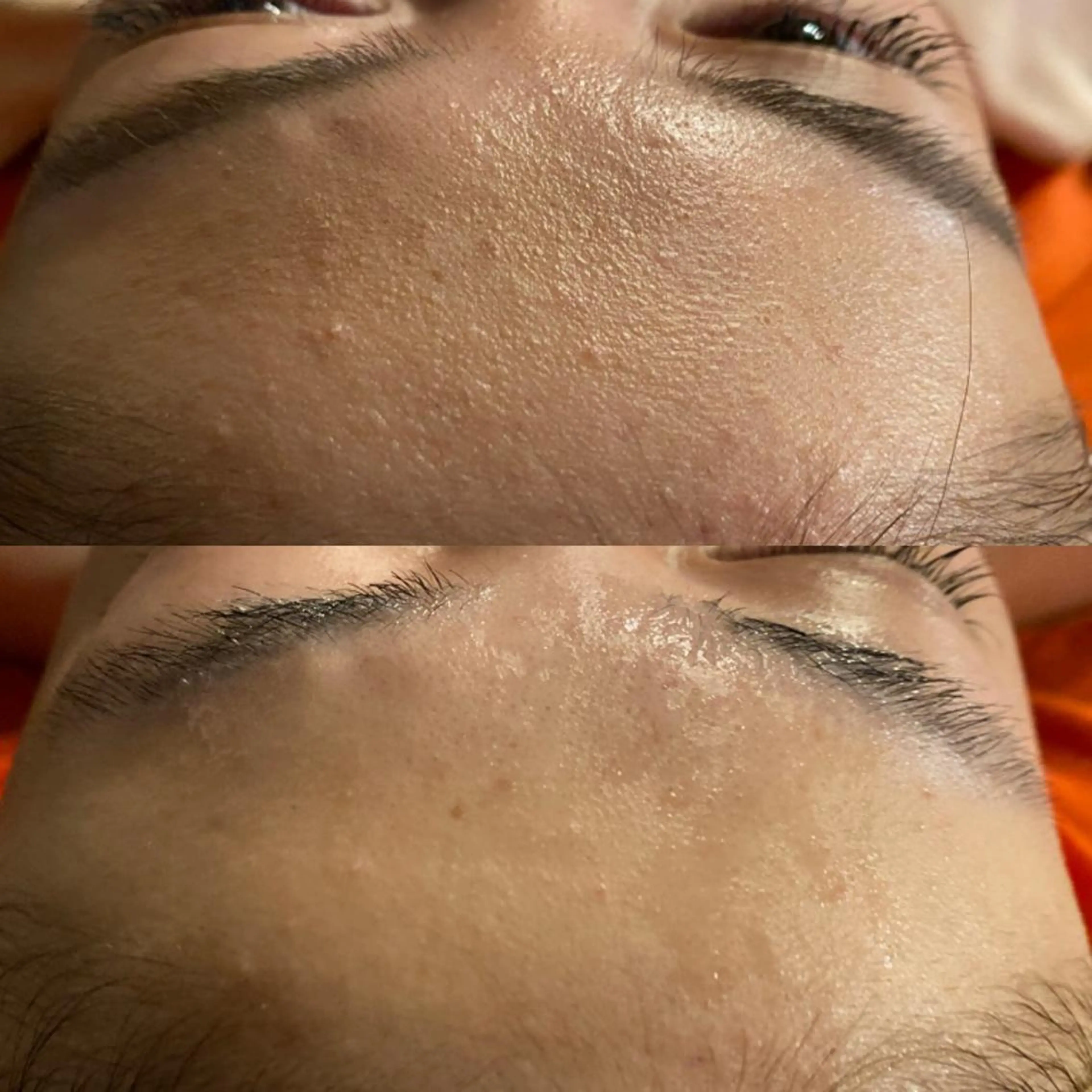 Mandarin Orange所属・毛穴から始める肌メン テマンダリンオレンジのエステ・リラクイメージ