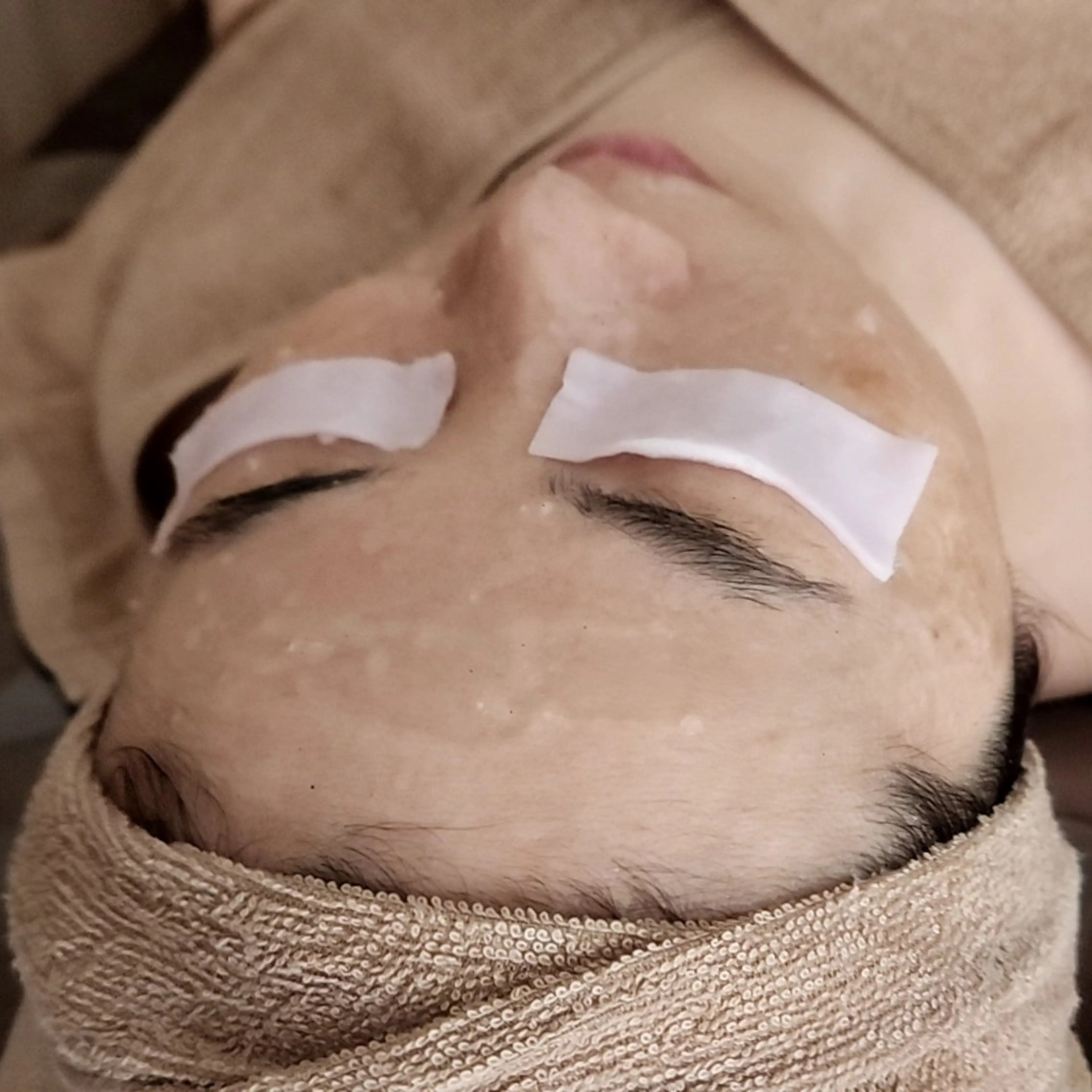 レストセルトリートメントの写真