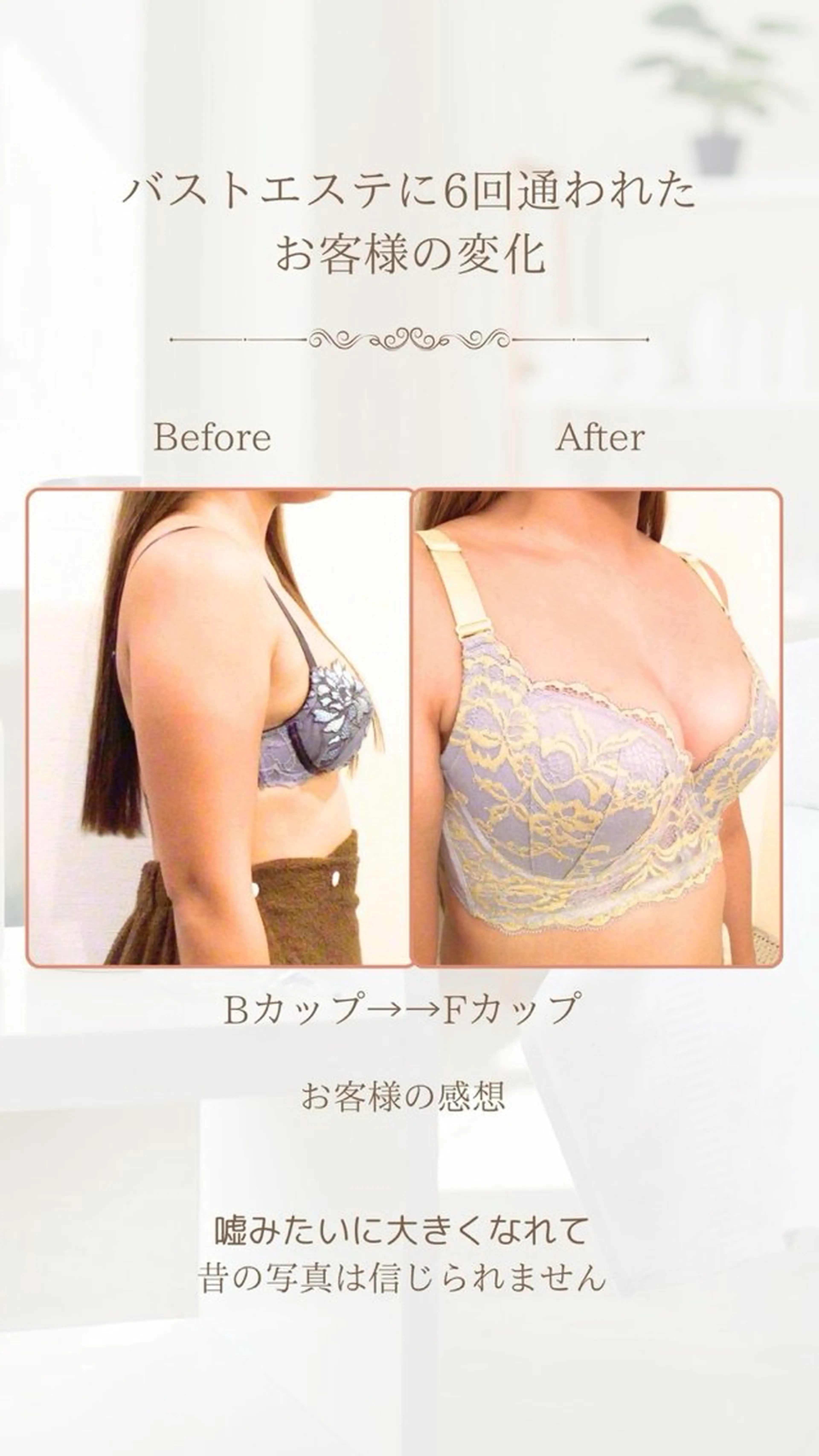 【美人バスト】美容液じゃ届かない部分にアプローチの写真