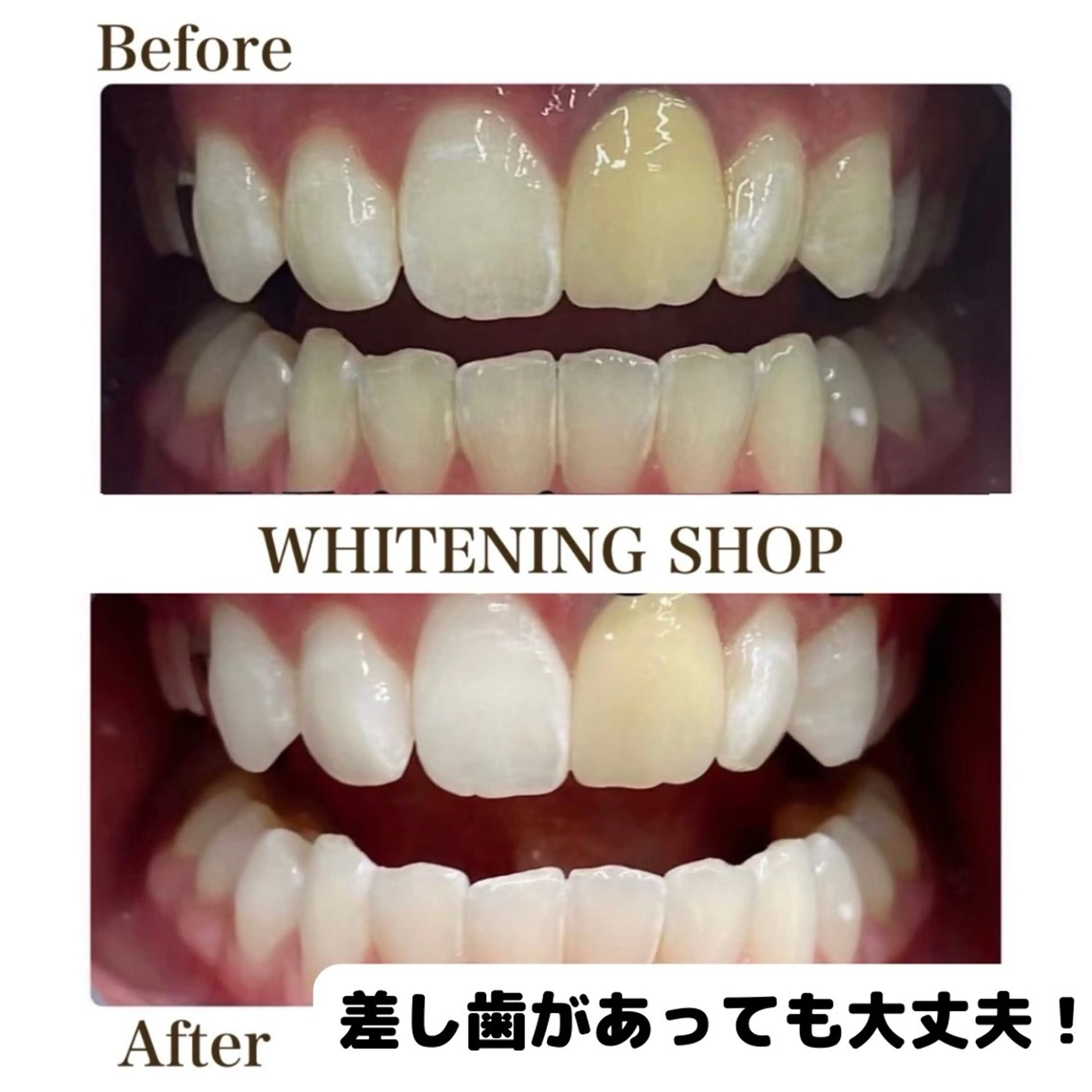 メンズ キッズ ホワイトニング ショップ多摩店のその他イメージ