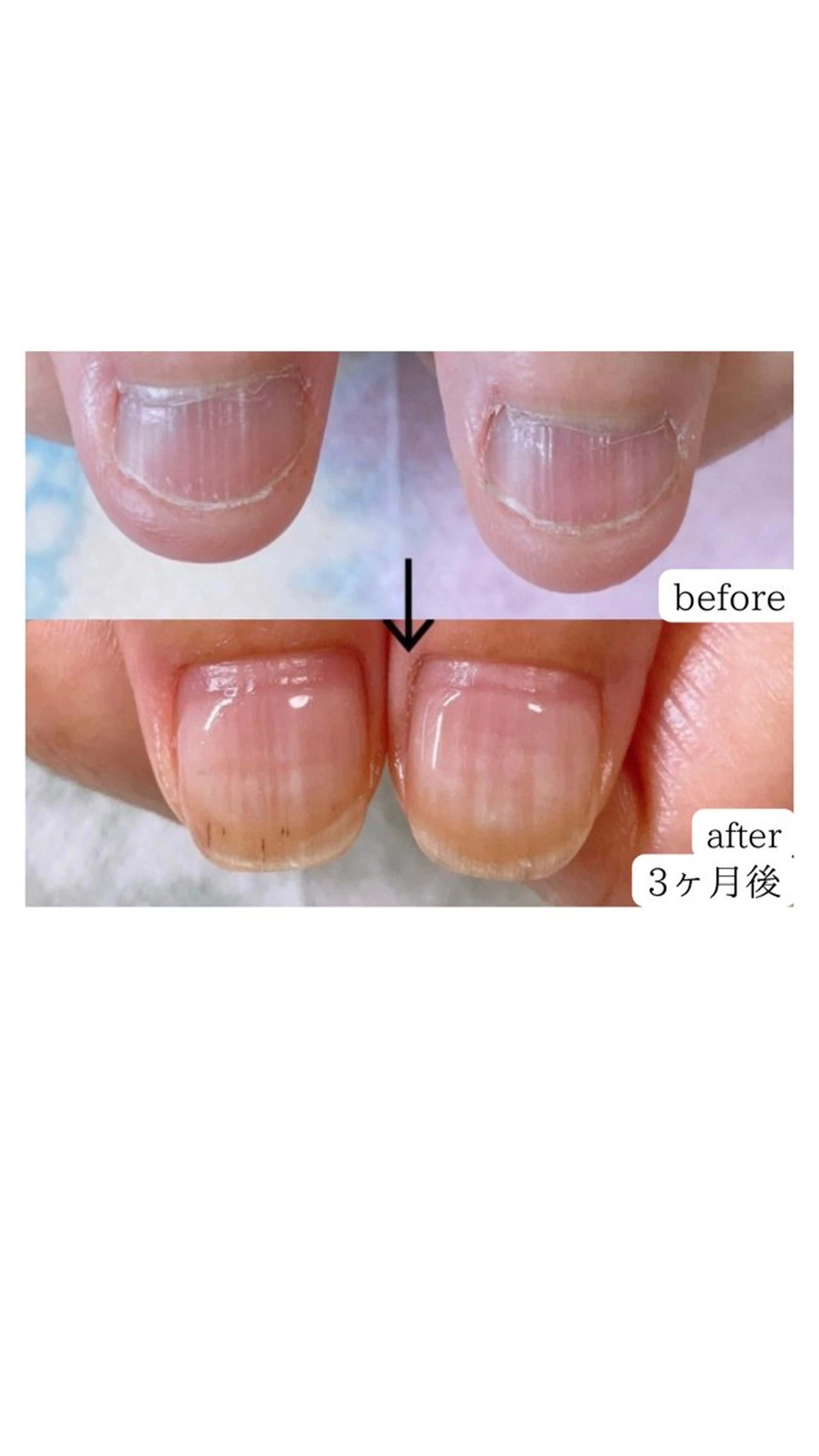 ネイル LIIRA(西船)/ やまださおりのネイルデザイン