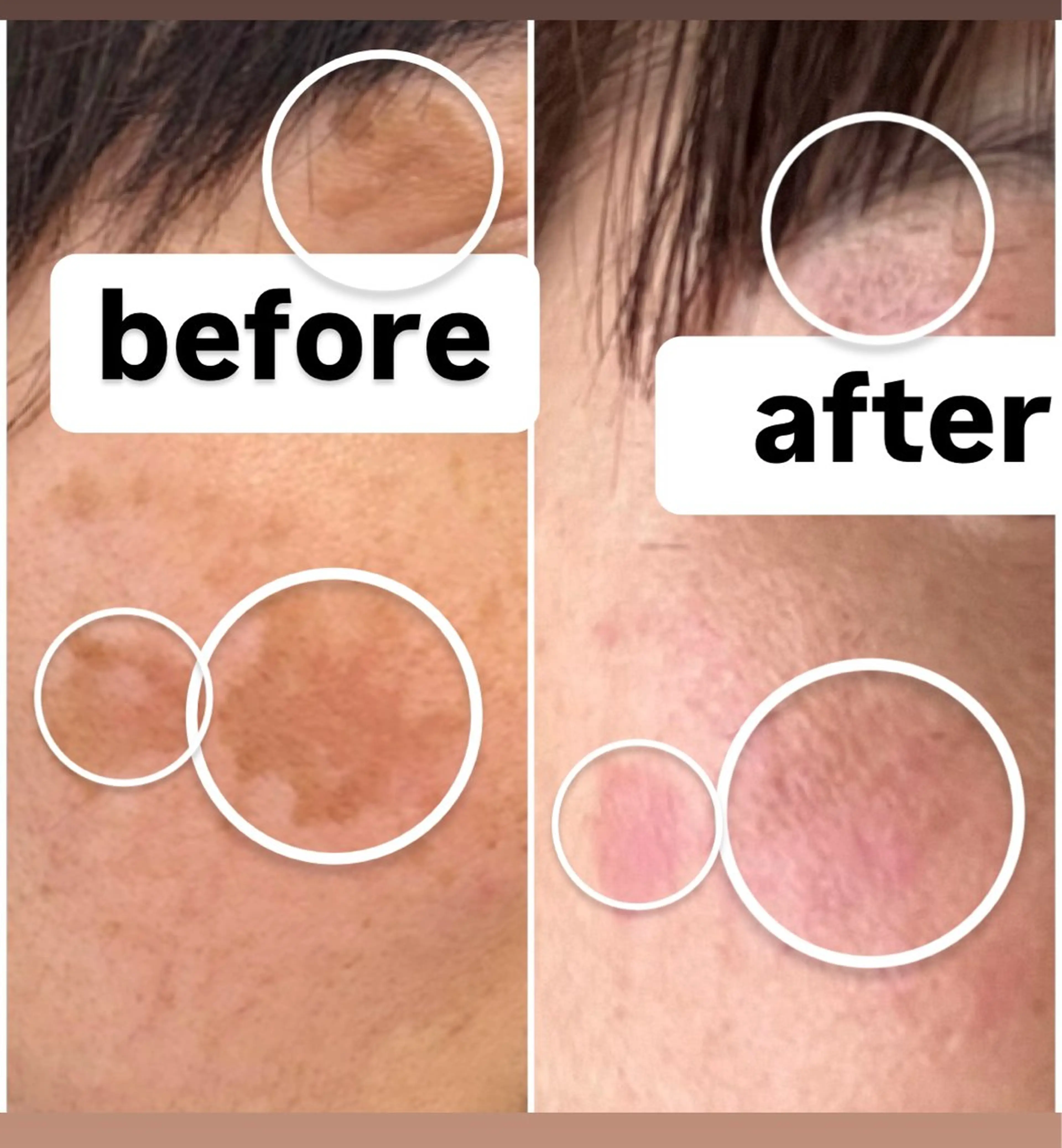 フェイシャルサロン藍 西谷由利のエステ・リラクイメージ