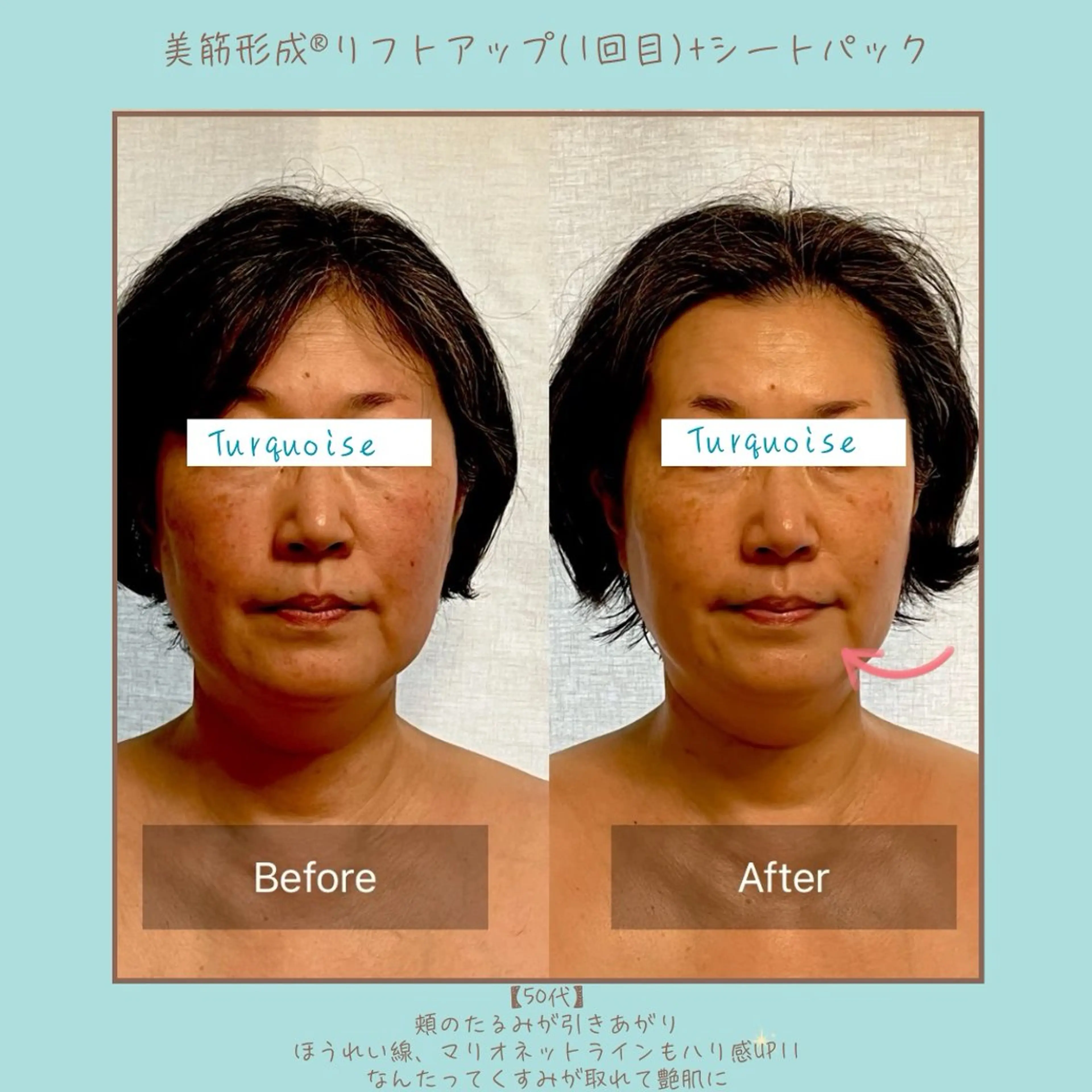 フェイシャルエステ Turquoiseのエステ・リラクイメージ