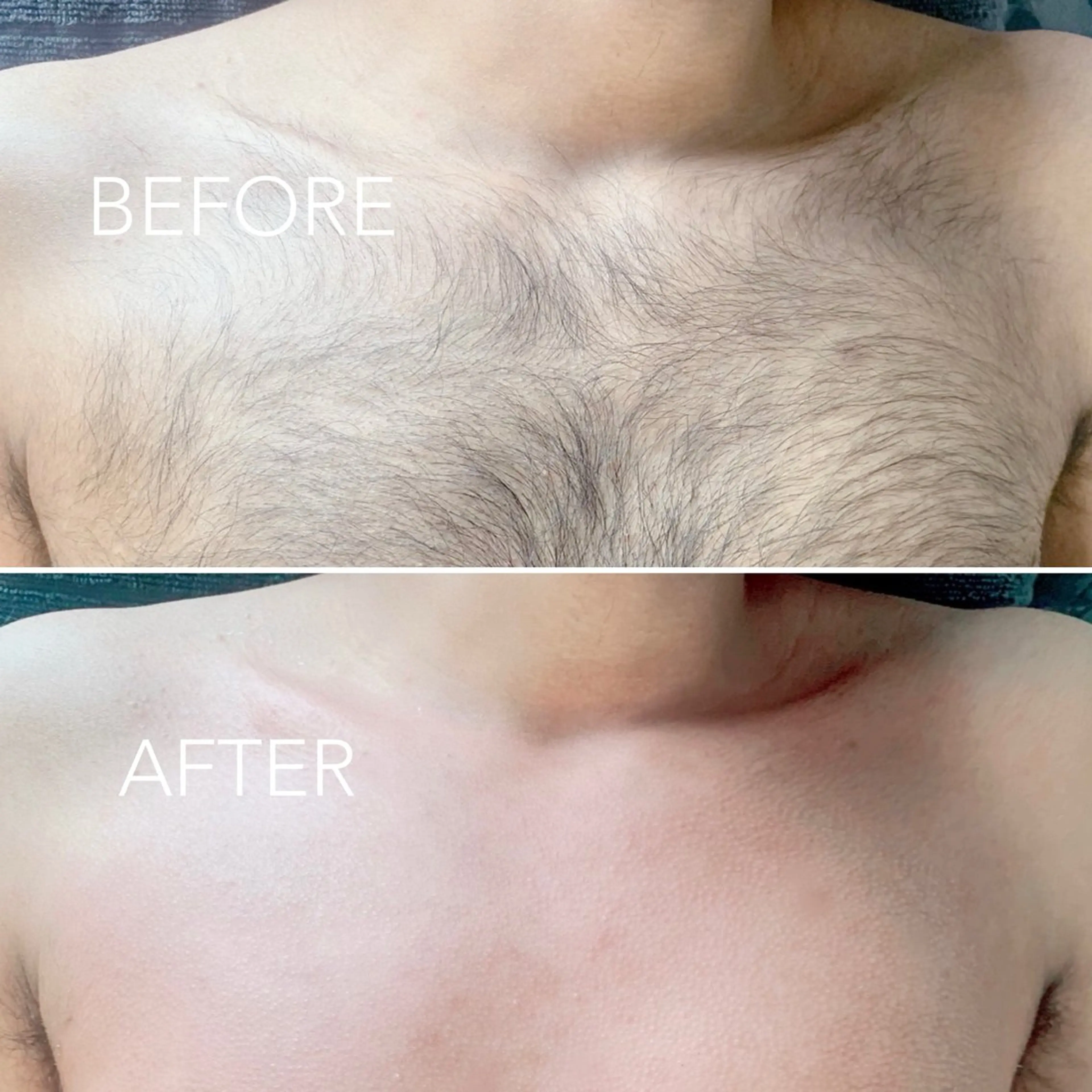 メンズ TREE WAX脱毛のエステ・リラクイメージ