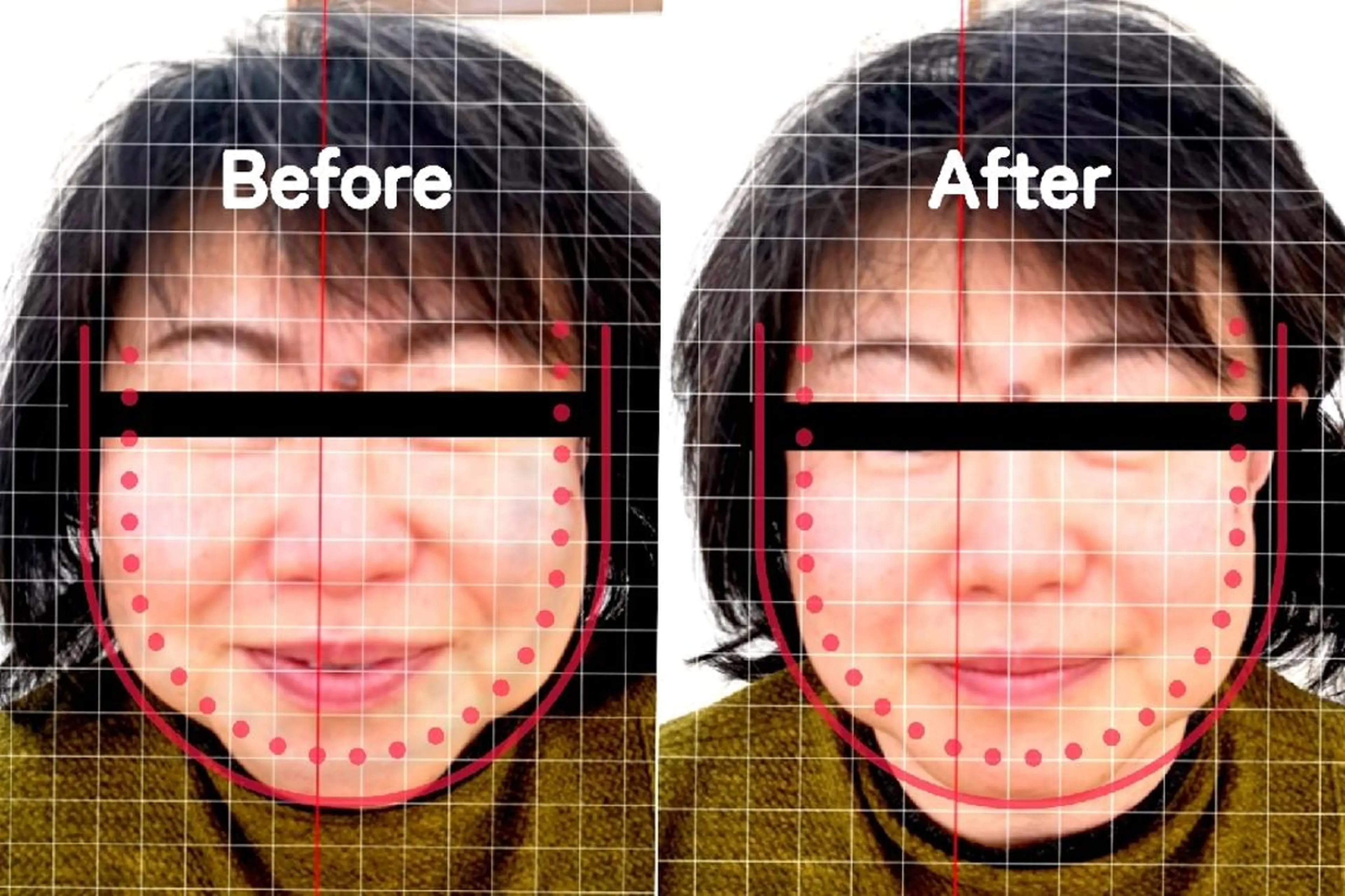 【全身整体・小顔矯正✕温活ハーブよもぎ蒸し100分】スッキリ！軽い！骨盤もしっかりケアの写真