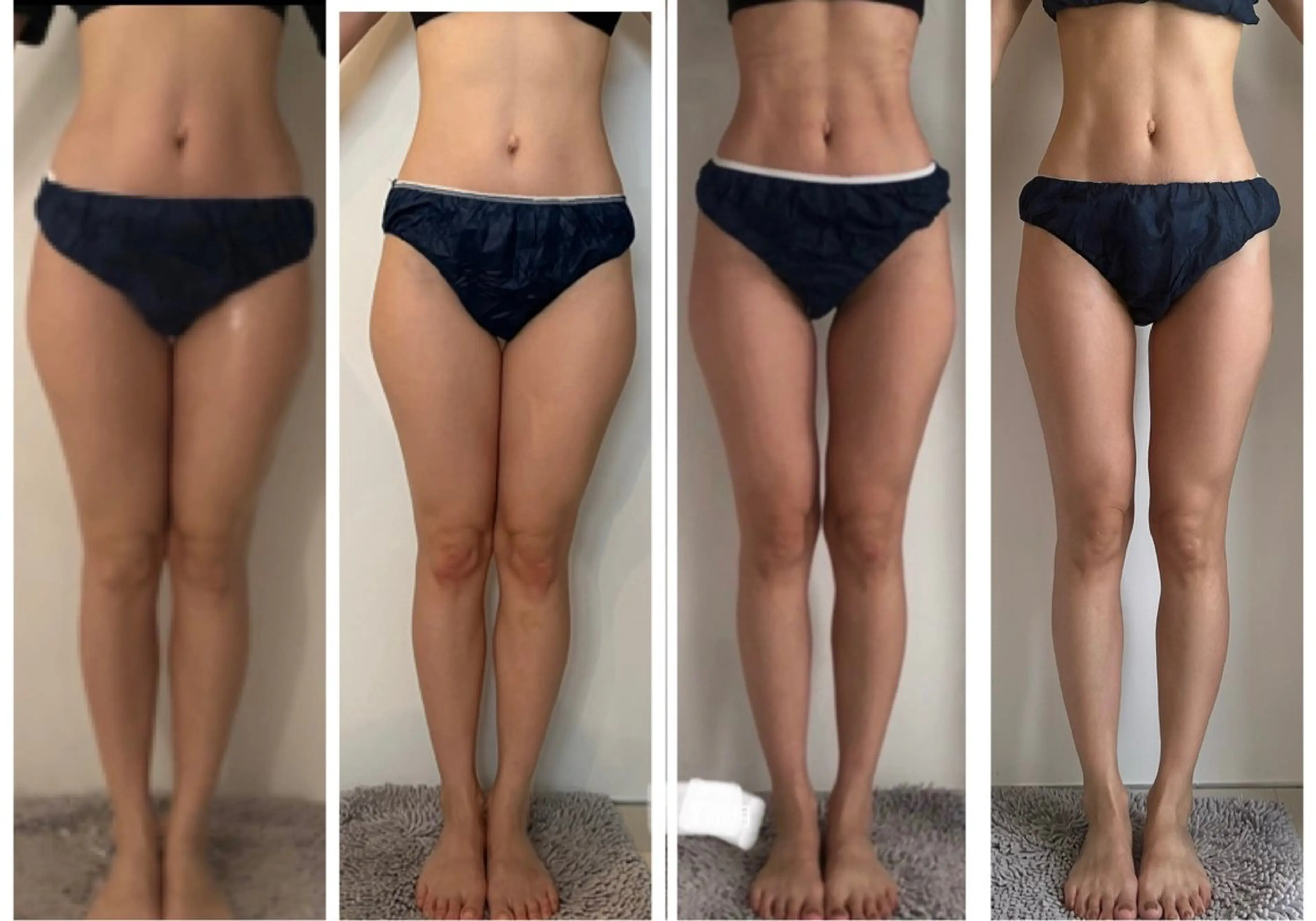 1番人気‼️全身✨これで全て解決！！！🌿100%無農薬よもぎ蒸し🌿🔥完全ダイエットコース！の写真