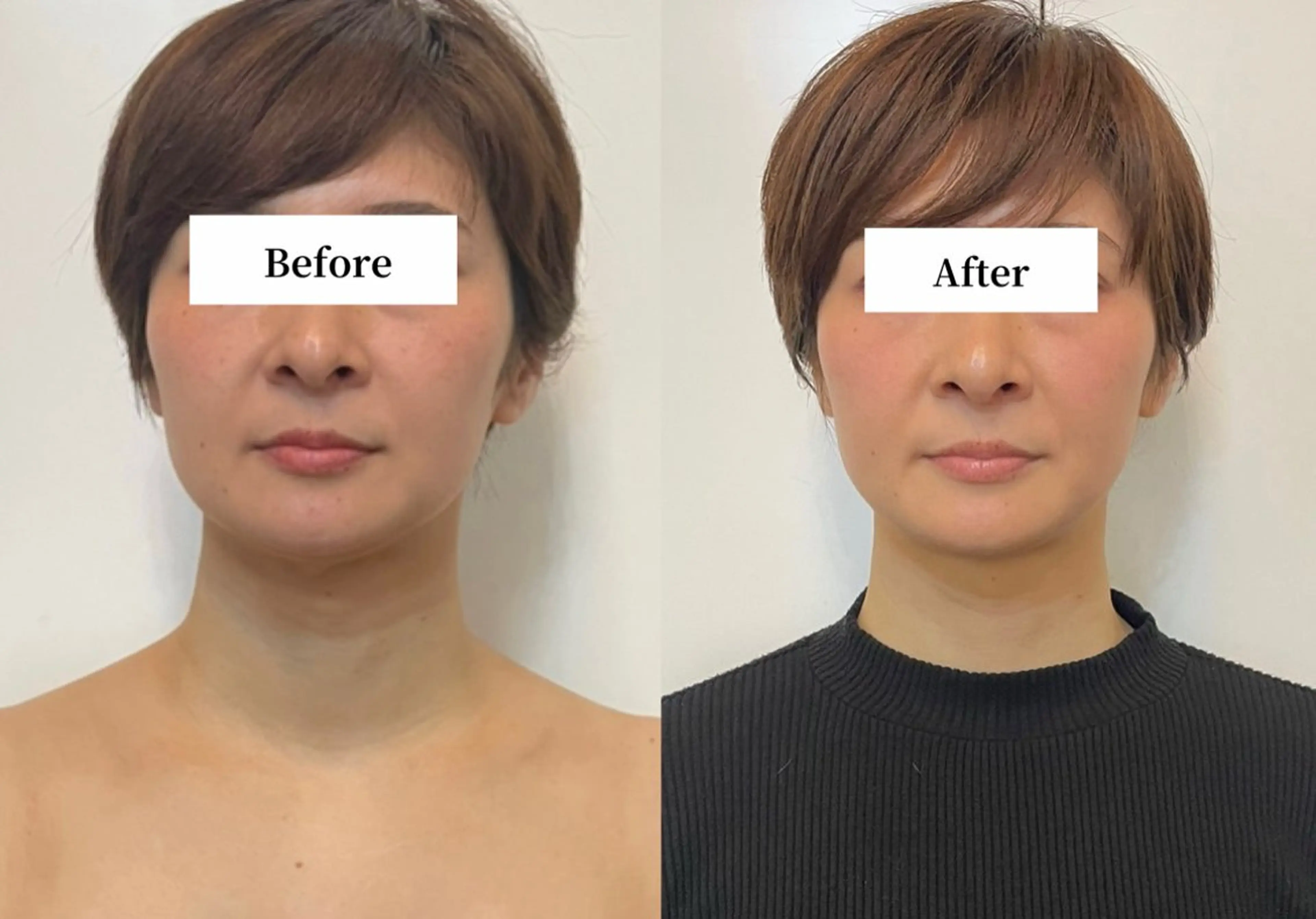 エステ リラク Private SalonOboraのエステ・リラクイメージ