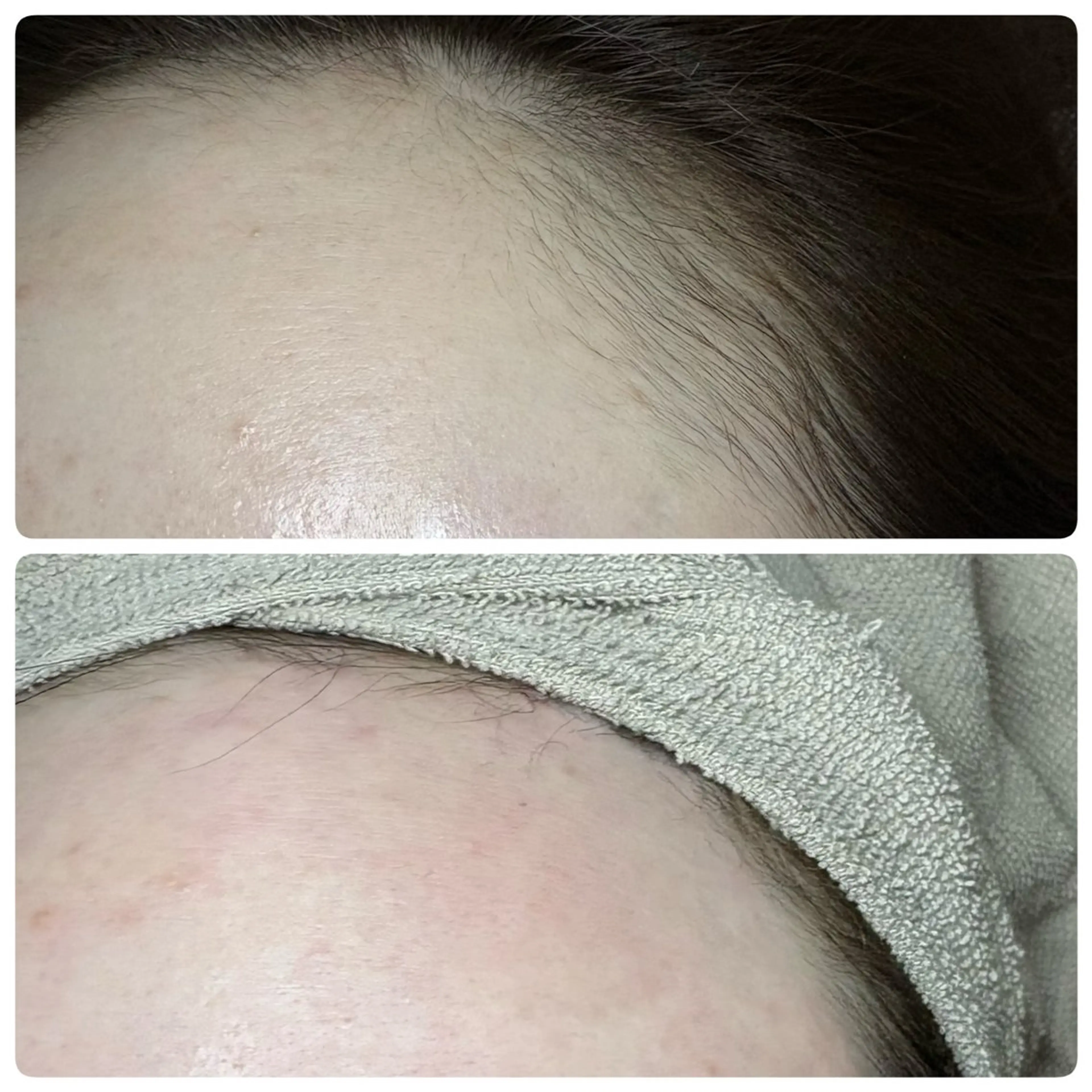 エステ A"-HILU(アーヒル)所属・A"-HILU （アーヒル)のエステ・リラクイメージ