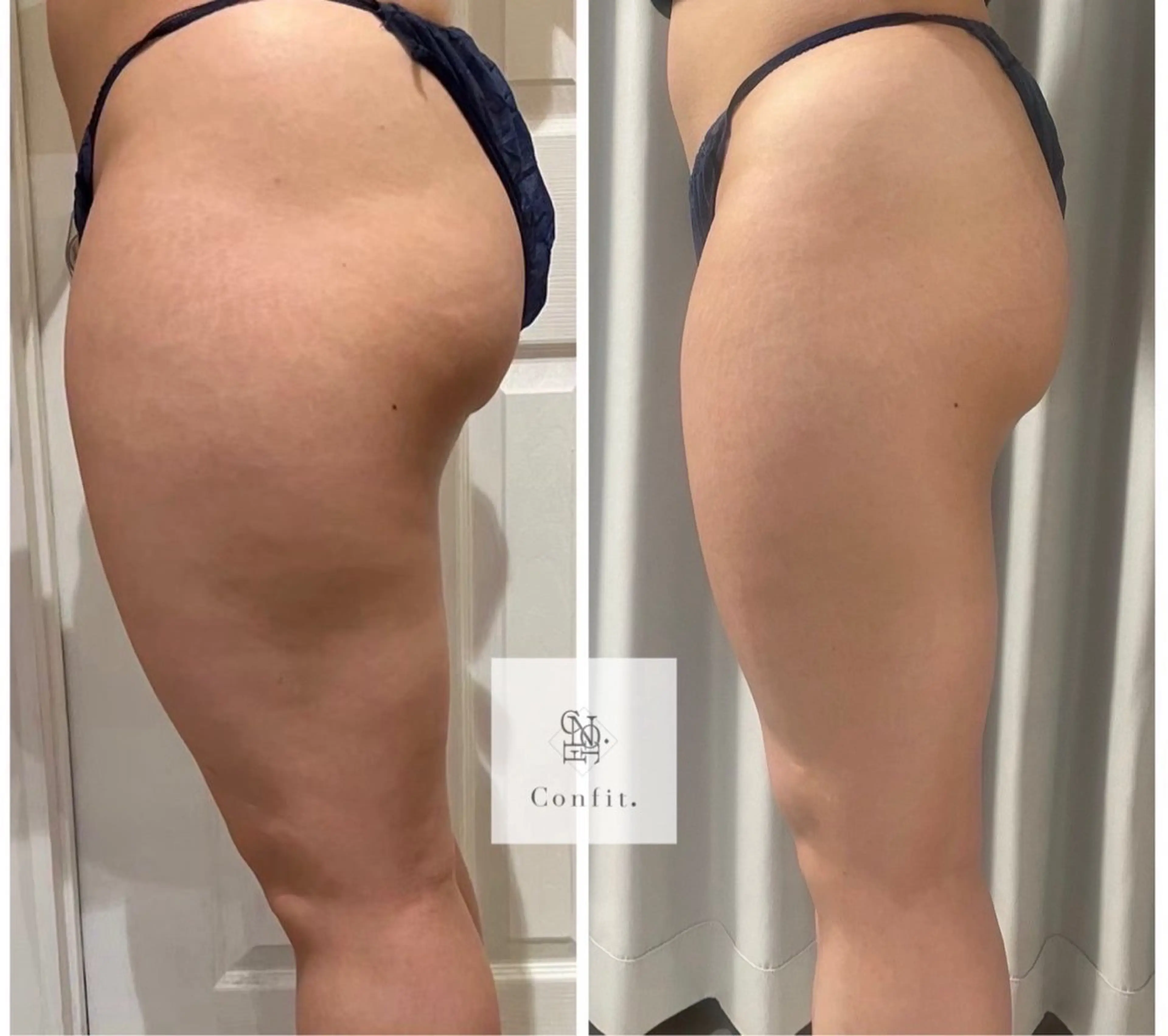 エステ 小顔/たるみ/黒ずみ除去専門サロン/SONA 大和西大寺店所属・【小顔痩身専門看護師 サロンSONA】のエステ・リラクイメージ