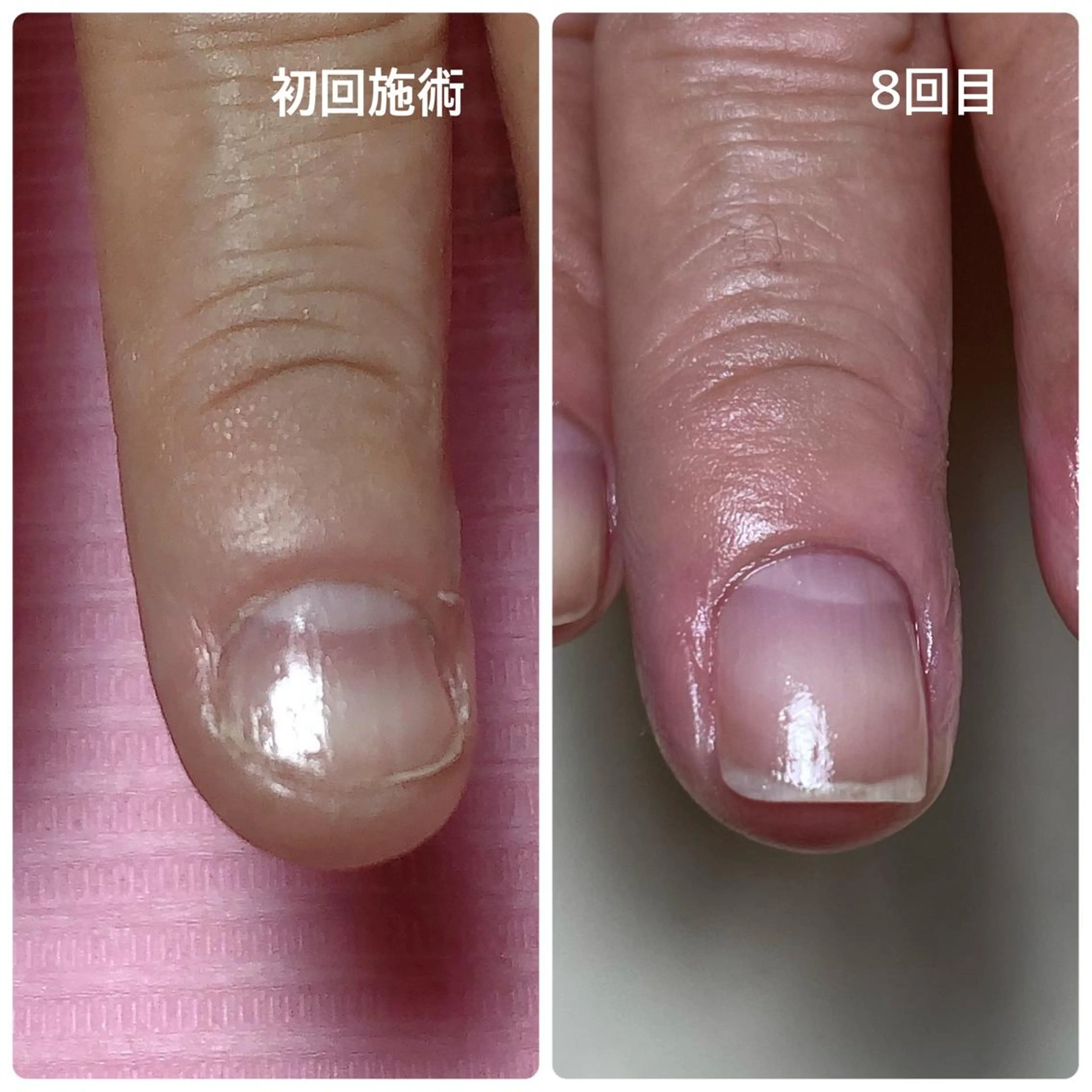 Nail ビ爪のネイルデザイン