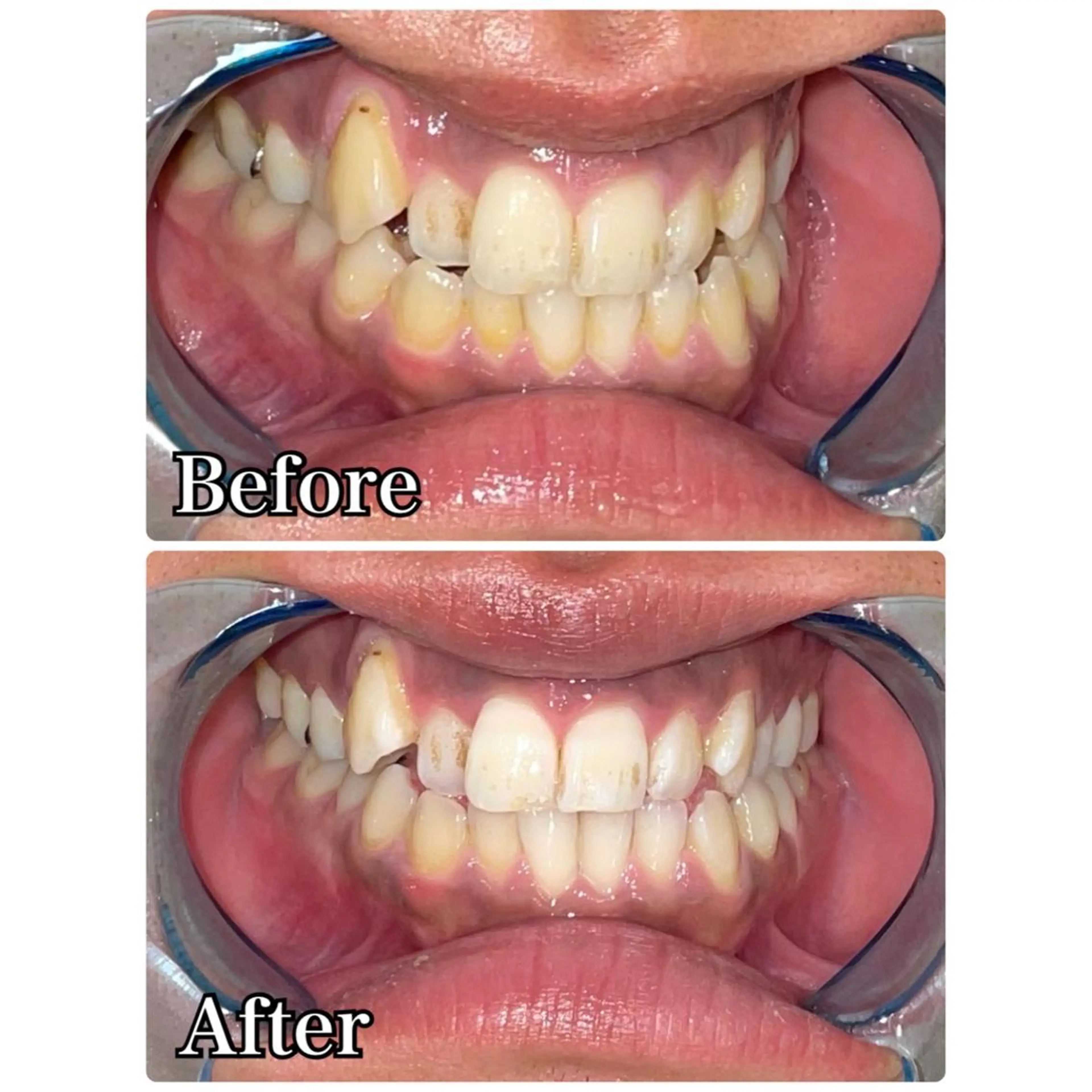 メンズ ☆専門店にお任せ☆ ホワイトニング吉祥寺のその他イメージ