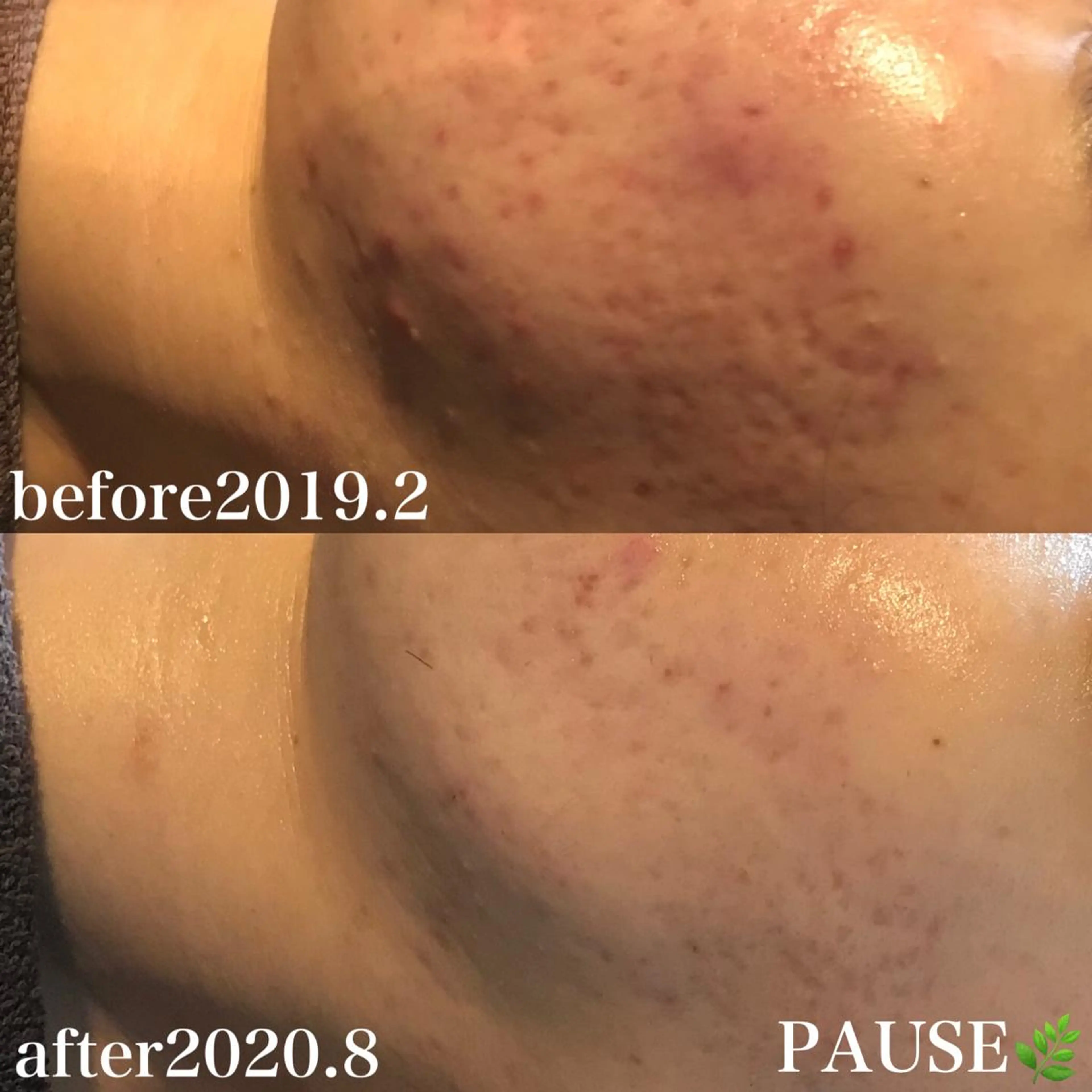 エステ 浜野 恵美のエステ・リラクイメージ