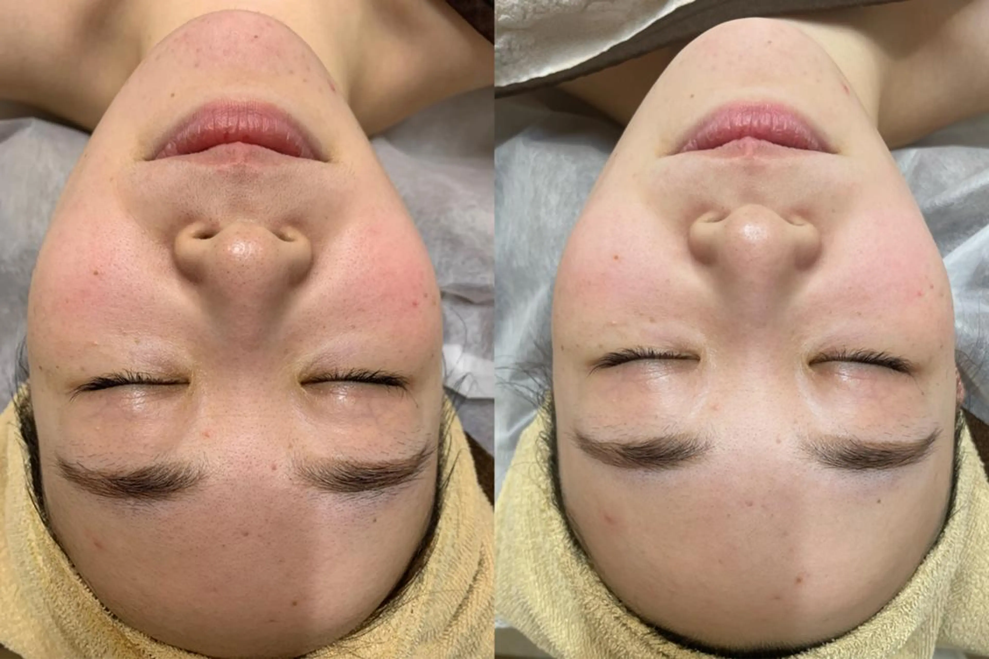 脱毛 エステティック RAYVIS池袋🐱のエステ・リラクイメージ