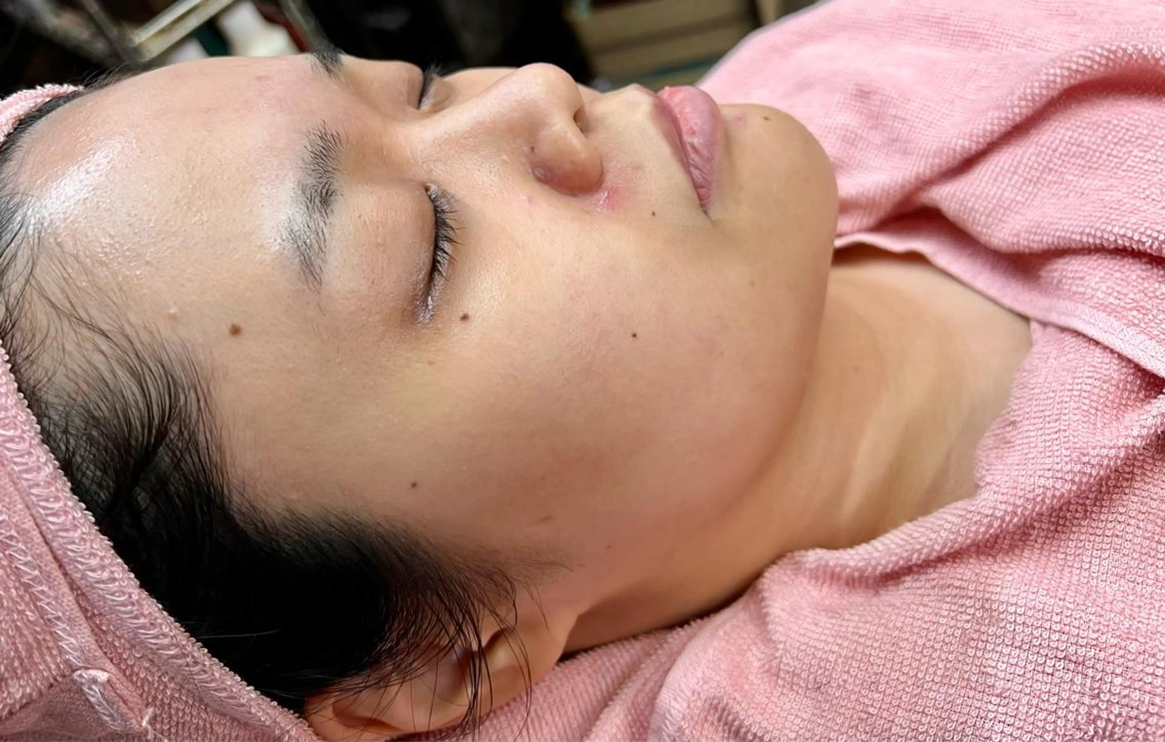 ✨全顔美肌レディースシェービング✨<うなじ/お顔+眉カット+リンパマッサージ+パック>【お肌のトータルケアに◎】の写真