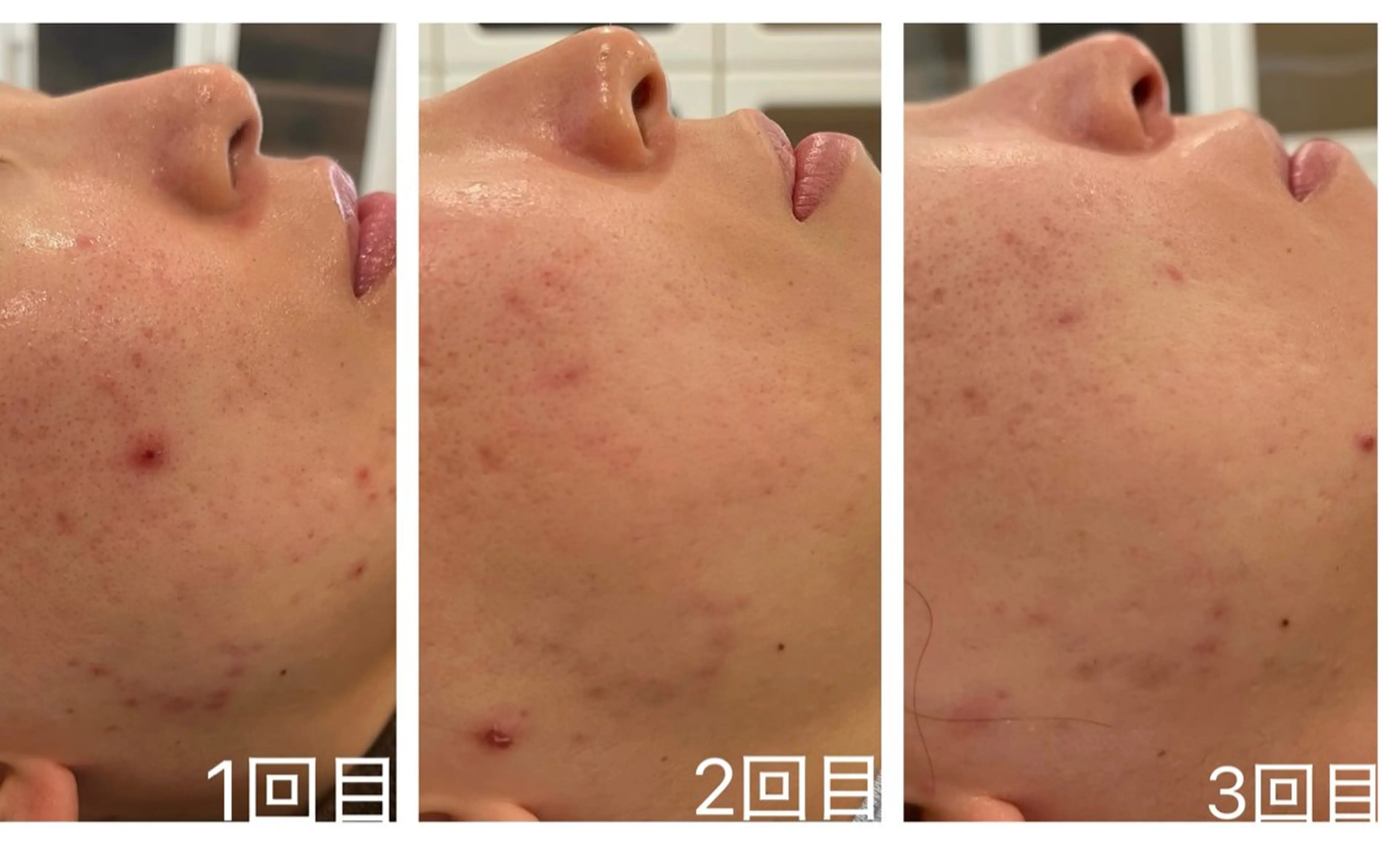 Belle原宿所属・佐藤 加奈のエステ・リラクイメージ