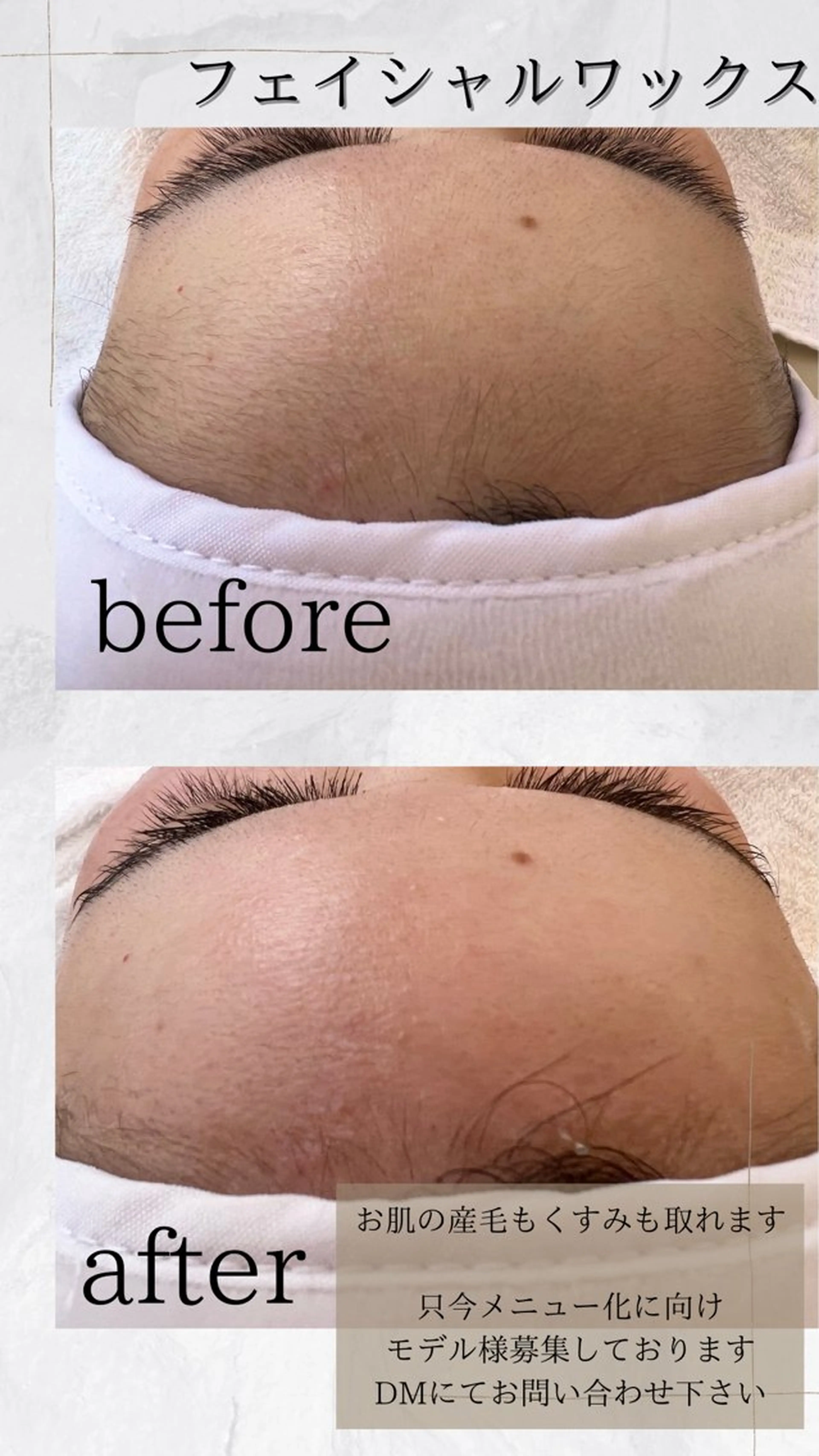 フェイシャルワックス全顔の写真