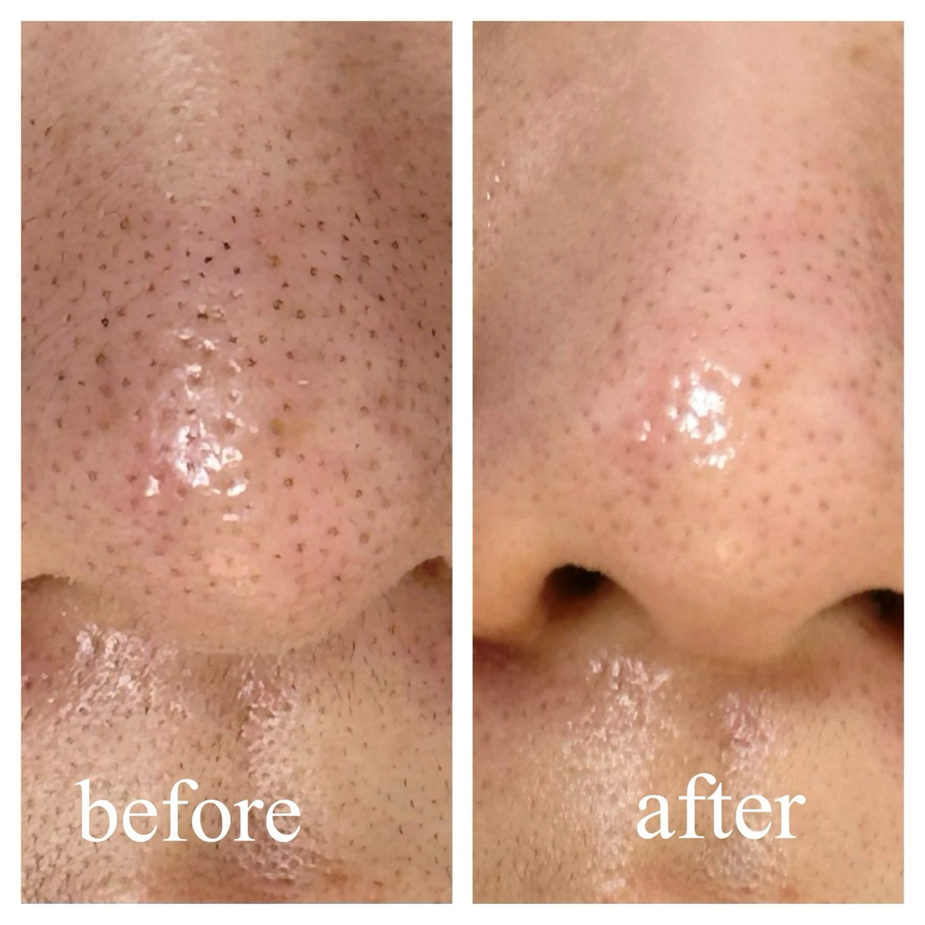 コアラル恵比寿店 chiakiのエステ・リラクイメージ